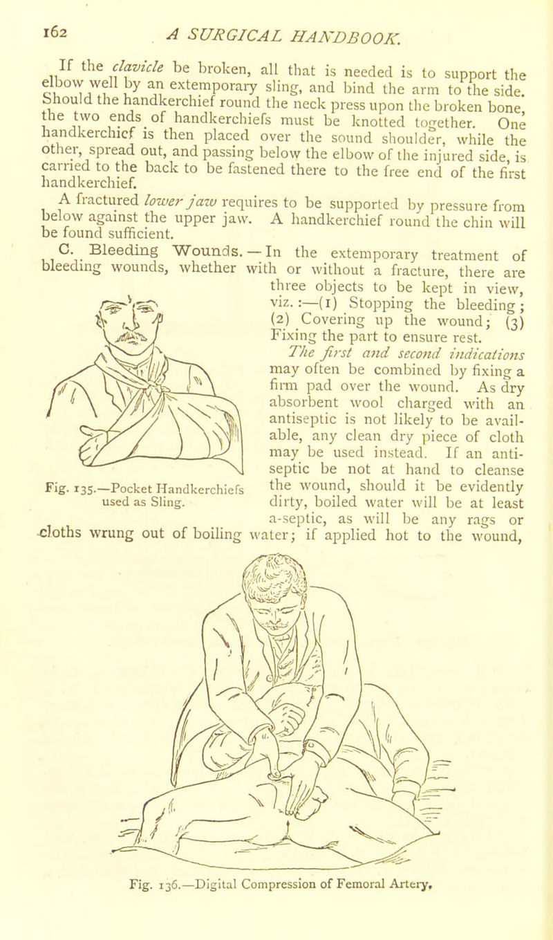 r62 If the clavicle be broken, all that is needed is to support the elbow well by an extemporaiy sling, and bind the arm to the side, bhould the handkerchief round the neck press upon the broken bone the two ends of handkerchiefs must be knotted together. One handkerchief is then placed over the sound shoulder, while the other, spread out, and passing below the elbow of the injured side is earned to the back to be fastened there to the free end of the first handkerchief. A fractured lower jazv requires to be supported by pressure from below against the upper jaw. A handkerchief round the chin will be found sufficient. C. _ Bleeding Wounds. —In the extemporary treatment of bleeding wounds, whether with or without a fracture, there are three objects to be kept in view, viz.:—(i) Stopping the bleeding; (2) Covering up the wound j (3) Fixing the part to ensure rest. The first and second indications may often be combined by fixing a firm pad over the wound. As dry absorbent wool charged with an antiseptic is not likely to be avail- able, any clean dry piece of cloth may be used instead. If an anti- septic be not at hand to cleanse the wound, should it be evidently dirty, boiled water will be at least a-septic, as will be any rags or Fig- 135-—Pocket Handkerchiefs used as Sling. .i-.icpLn_, tib vvuL uc any rags or .cloths wrung out of boiling water; if applied hot to the wound, Fig. 136.—Digital Compression of Femoral Artery,