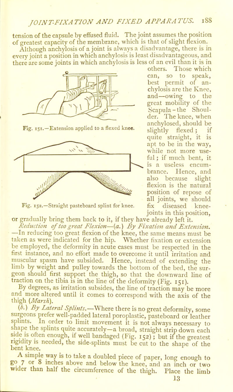 Fig. 151.—E.xtensioii applied to a flexed knee. tension of the capsule by effused fluid. The joint assumes the position of greatest capacity of the membrane, which is that of slight flexion. Although anchylosis of a joint is always a disadvantage, there is in every joint a position in which anchylosis is least disadvantageous, and there are some joints in which anchylosis is less of an evil than it is in others. Those which can, so to speak, best permit of an- chylosis are the Knee, and—owing to the great mobility of the Scapula-the Shoul- der. The knee, when anchylosed, should be slightly flexed; if quite straight, it is apt to be in the way, while not more use- ful ; if much bent, it is a useless encum- brance. Hence, and also because slight flexion is the natural position of repose of all joints, we should fix diseased knee- joints in this position, or gradually bring them back to it, if they have already left it. Reduction of too great Flexion—{a.) By Fixation and Extension. —In reducing too great flexion of the knee, the same means must be taken as were indicated for the hip. Whether fixation or extension be employed, the deformity in acute cases must be respected in the first instance, and no effort made to overcome it until irritation and muscular spasm have subsided. Hence, instead of extending the limb by weight and pulley towards the bottom of the bed, the sur- geon should first support the thigh, so that the downward line of traction on the tibia is in the line of the deformity (Fig. 151). By degrees, as irritation subsides, the line of traction may be more and more altered until it comes to correspond with the axis of the thigh {Marsh). (6.) By Lateral Splints.—Where there is no great deformity, some surgeons prefer well-padded lateral poroplastic, pasteboard or leather splints. In order to limit movement it is not always necessary to shape the splints quite accurately—a broad, straight strip down each side IS often enough, if well bandaged (Fig. 152); but if the greatest rigidity IS needed, the side-splints must be cut to the shape of the Lent knee. A simple way is to take a doubled piece of paper, long enough to go 7 or 8 inches above and below the knee, and an inch or two wider than half the circumference of the thigh. Place the limb 13 152.—Straight pasteboard splint for knee.