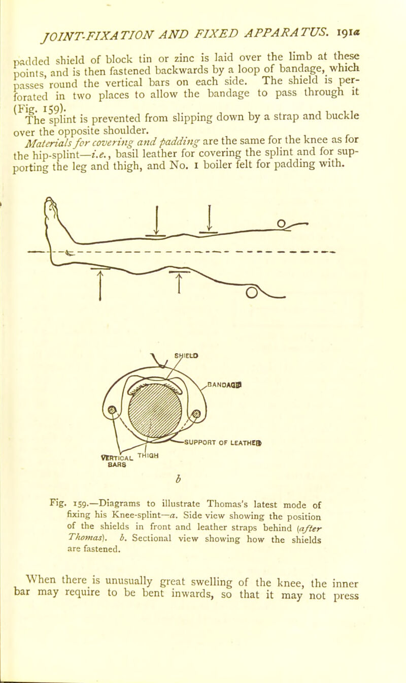 padded shield of block tin or zinc is laid over the limb at these points, and is then fastened backwards by a loop of bandage,_ which passes'round the vertical bars on each side. The shield is per- forated in two places to allow the bandage to pass through it ^^The splint is prevented from slipping down by a strap and buckle over the opposite shoulder. Materials for covering and padding are the same for the knee as for the hip-splint—z.e., basil leather for covering the splint and for sup- porting the leg and thigh, and No. I boiler felt for padding with. Fig. 159.—Diagrams to illustrate Thomas's latest mode of fixing his Knee-splint—a. Side view showing the position of the shields in front and leather straps behind (after Thomas), b. Sectional view showing how the shields are fastened. When there is unusually great swelling of the knee, the inner bar may require to be bent inwards, so that it may not press