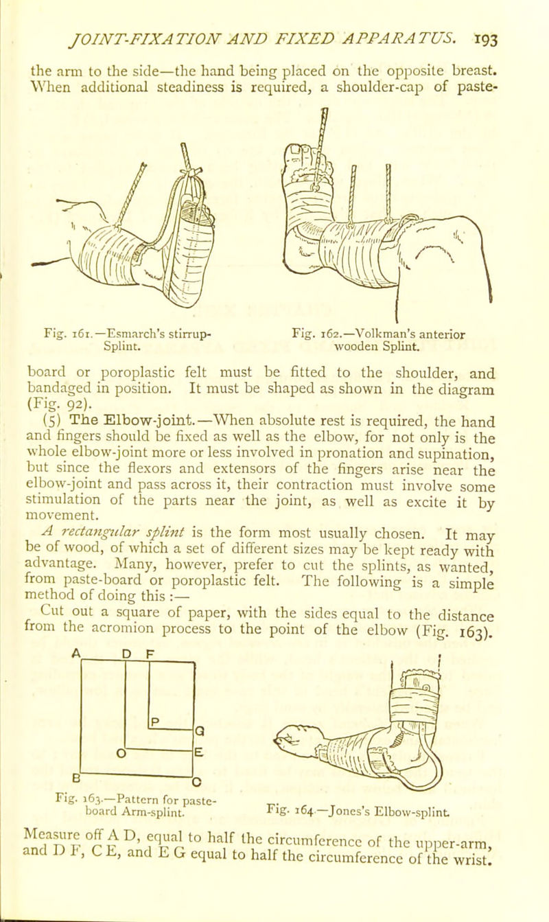 the arm to the side—the hand being placed on the opposite breast. When additional steadiness is required, a shoulder-cap of paste- Fig. 161.—Esmarch's stirrup- Spliut. 162.—Volkman's anterior wooden Splint. board or poroplastic felt must be fitted to the shoulder, and bandaged in position. It must be shaped as shown in the diagram (Fig. 92). (S) The Elbow-joint.—When absolute rest is required, the hand and fingers should be fixed as well as the elbow, for not only is the whole elbow-joint more or less involved in pronation and supination, but since the fle.xors and extensors of the fingers arise near the elbow-joint and pass across it, their contraction must involve some stimulation of the parts near the joint, as well as excite it by movement. A recttmgidar splint is the form most usually chosen. It may be of wood, of which a set of different sizes may be kept ready with advantage. Many, however, prefer to cut the splints, as wanted, from paste-board or poroplastic felt. The following is a simple method of doing this :— Cut out a square of paper, with the sides equal to the distance from the acromion process to the point of the elbow (Fig. 163). Fig. 16.V—Pattern for paste- board Arm-splint. Fig. 164 —Jones's Elbow-splint Jld'n F °r F °' n '° -^^ circumference of the upper-arm, and D CL, and E G equal to half the circumference of the wrist!