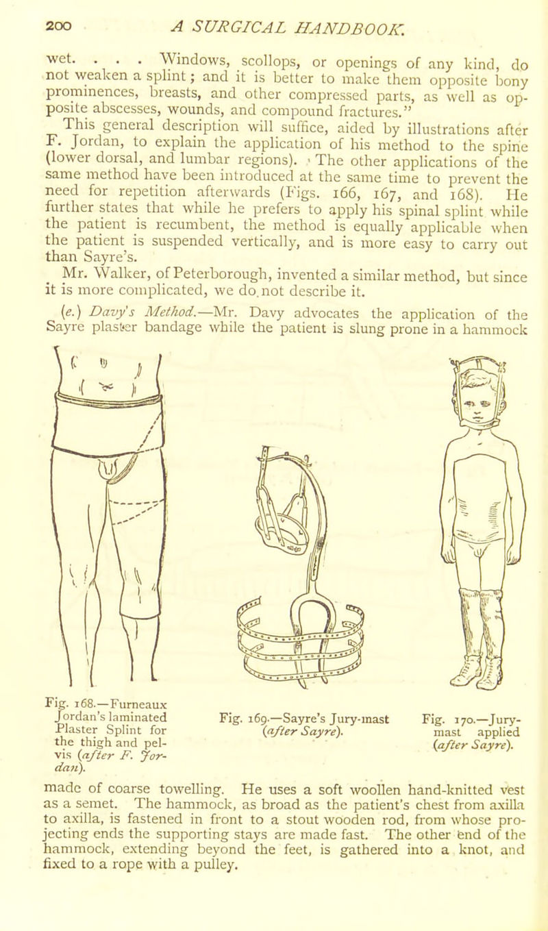 ^•^t. . . . Windows, scollops, or openings of any kind, do not weaken a splint; and it is better to make them opposite bony prommences, breasts, and other compressed parts, as well as op- posite abscesses, wounds, and compound fractures. This general description will suffice, aided by illustrations after F. Jordan, to explain the application of his method to the spine (lower dorsal, and lumbar regions). - The other applications of the same method have been introduced at the same time to prevent the need for repetition afterwards (Figs. i66, 167, and 168). He further states that while he prefers to apply his spinal splint while the patient is recumbent, the method is equally applicable when the patient is suspended vertically, and is more easy to carry out than Sayre's. Mr. Walker, of Peterborough, invented a similar method, but since it is more complicated, we do. not describe it. (e.) Davy's Method.—Mr. Davy advocates the application of the Sayre plast-cr bandage while the patient is slung prone in a hammock Fig. 168.—Furneaux Jordan's laminated Fig. 169.—Sayre's Jury-mast Fig. 170.—Jury- Plaster Splint for (after Sayre). mast applied the thigh and pel- {after Sayre). VIS {after F. jor- dan). made of coarse towelling. He uses a soft woollen hand-knitted vest as a semet. The hammock, as broad as the patient's chest from axilla to axilla, is fastened in front to a stout wooden rod, from whose pro- jecting ends the supporting stays are made fast. The other fend of the hammock, extending beyond the feet, is gathered into a knot, and fixed to a rope with a pulley.