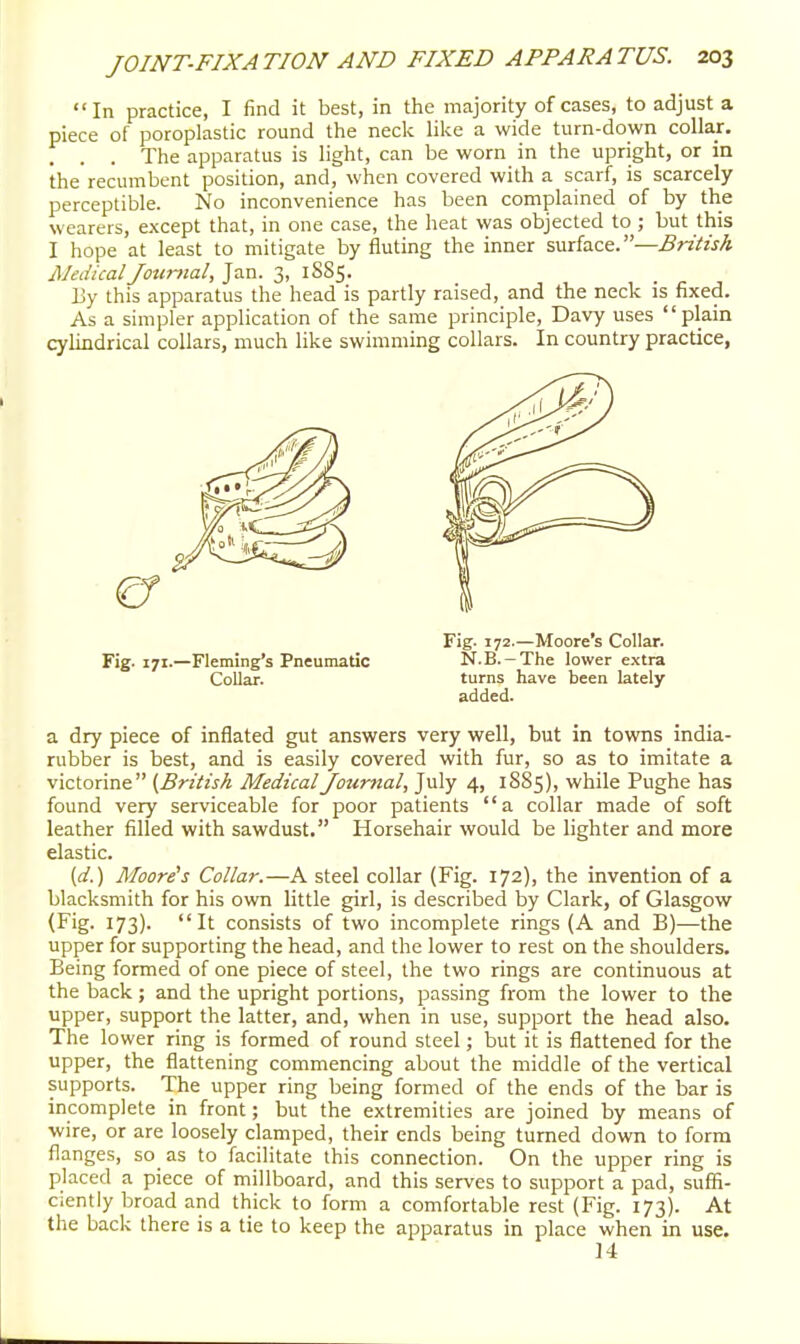 In practice, I find it best, in the majority of cases, to adjust a piece of poroplastic round the neck like a wide turn-down collar. The apparatus is light, can be worn in the upright, or in the recumbent position, and, when covered with a scarf, is scarcely perceptible. No inconvenience has been complained of by the wearers, except that, in one case, the heat was objected to ; but this I hope at least to mitigate by fluting the inner surface.—British MedicalJotmial, Jan. 3, 1885. liy this apparatus the head is partly raised, and the neck is fixed. As a simpler application of the same principle, Davy uses plain cylindrical collars, much like swimming collars. In country practice, Fig- 172.—Moore's Collar. Fig. 171.—Fleming's Pneumatic N.B.-The lower e.\tra Collar. turns have been lately added. a dry piece of inflated gut answers very well, but in towns india- rubber is best, and is easily covered with fur, so as to imitate a victorine {British Medical Journal, July 4, 1S85), while Pughe has found very serviceable for poor patients a collar made of soft leather filled with sawdust, Horsehair would be lighter and more elastic. (d.) Moore's Collar.—A steel collar (Fig. 172), the invention of a blacksmith for his own little girl, is described by Clark, of Glasgow (Fig. 173). It consists of two incomplete rings (A and B)—the upper for supporting the head, and the lower to rest on the shoulders. Being formed of one piece of steel, the two rings are continuous at the back; and the upright portions, passing from the lower to the upper, support the latter, and, when in use, support the head also. The lower ring is formed of round steel; but it is flattened for the upper, the flattening commencing about the middle of the vertical supports. The upper ring being formed of the ends of the bar is incomplete in front; but the extremities are joined by means of wire, or are loosely clamped, their ends being turned down to form flanges, so_ as to facilitate this connection. On the upper ring is placed a piece of millboard, and this serves to support a pad, suffi- ciently broad and thick to form a comfortable rest (Fig. 173). At the back there is a tie to keep the apparatus in place when in use. M