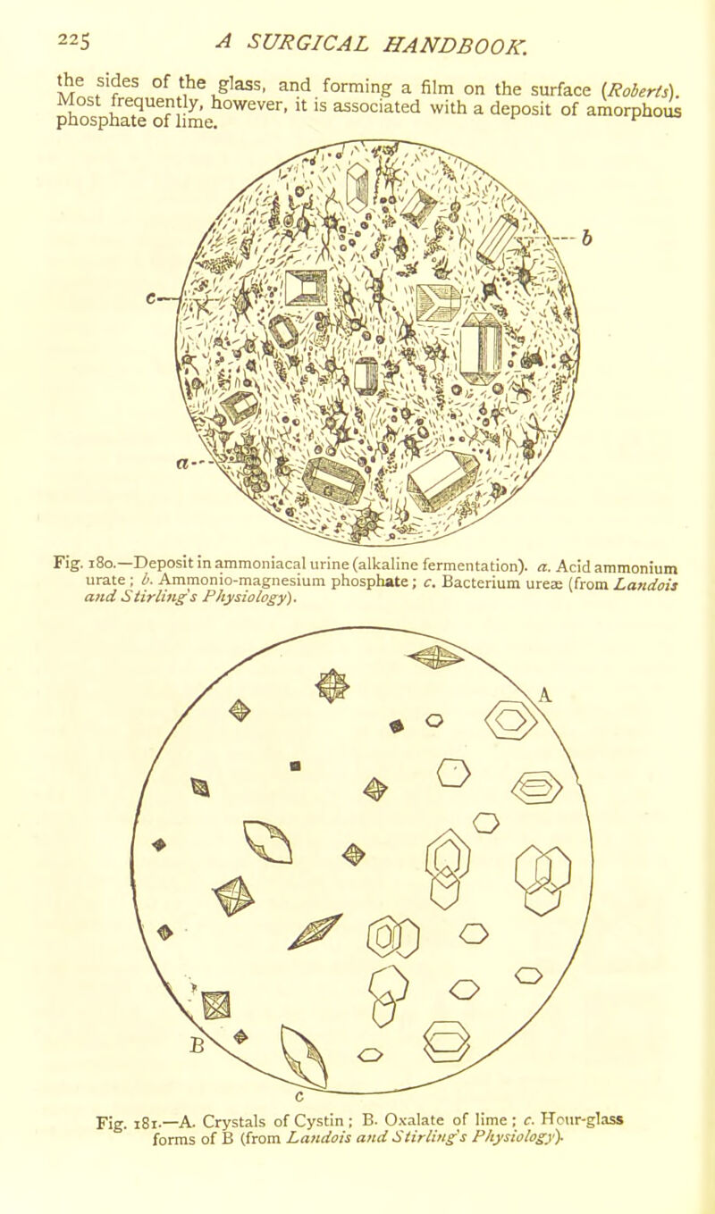 the sides of the glass, and forming a film on the surface i,RobeHs\. ^ospfaTofSme  '''^ ^ deposit of amorphoi Fig. i8o.—Deposit in ammoniacal urine (alljaline fermentation), a. Acid ammonium urate ; b. Ammonio-magnesium phosphate; c. Bacterium urea; (from Landois and Stirlings Physiology). Fig. i8i.—A. Crystals of Cystin ; B. Oxalate of lime ; c. Hcur-glass forms of B (from Landois and Stirling's P/iysiology)-