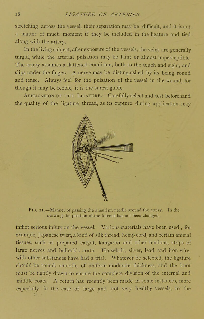 stretching across the vessel, their separation may be difficult, and it is nut a matter of much moment if they be included in the ligature and tied along with the artery. In the living subject, after exposure of the vessels, the veins are generally turgid, while the arterial pulsation may be faint or almost imperceptible. The artery assumes a flattened condition, both to the touch and sight, and slips under the finger. A nerve may be distinguished by its being round and tense. Always feel for the pulsation of the vessel in the wound, for though it may be feeble, it is the surest guide. Application of the Ligature.—Carefully select and test beforehand the quality of the ligature thread, as its rupture during application may Fig. 21.—Manner of passing the aneurism needle around the artery. In the drawing the position of the forceps has not been changed. inflict serious injury on the vessel. Various materials have been used ; for example, Japanese twist, a kind of silk thread, hemp cord, and certain animal tissues, such as prepared catgut, kangaroo and other tendons, strips of large nerves and bullock's aorta. Horsehair, silver, lead, and iron wire, with other substances have had a trial. Whatever be selected, the ligature should be round, smooth, of uniform moderate thickness, and the knot must be tightly drawn to ensure the complete division of the internal and middle coats. A return has recently been made in some instances, more especially in the case of large and not very healthy vessels, to the