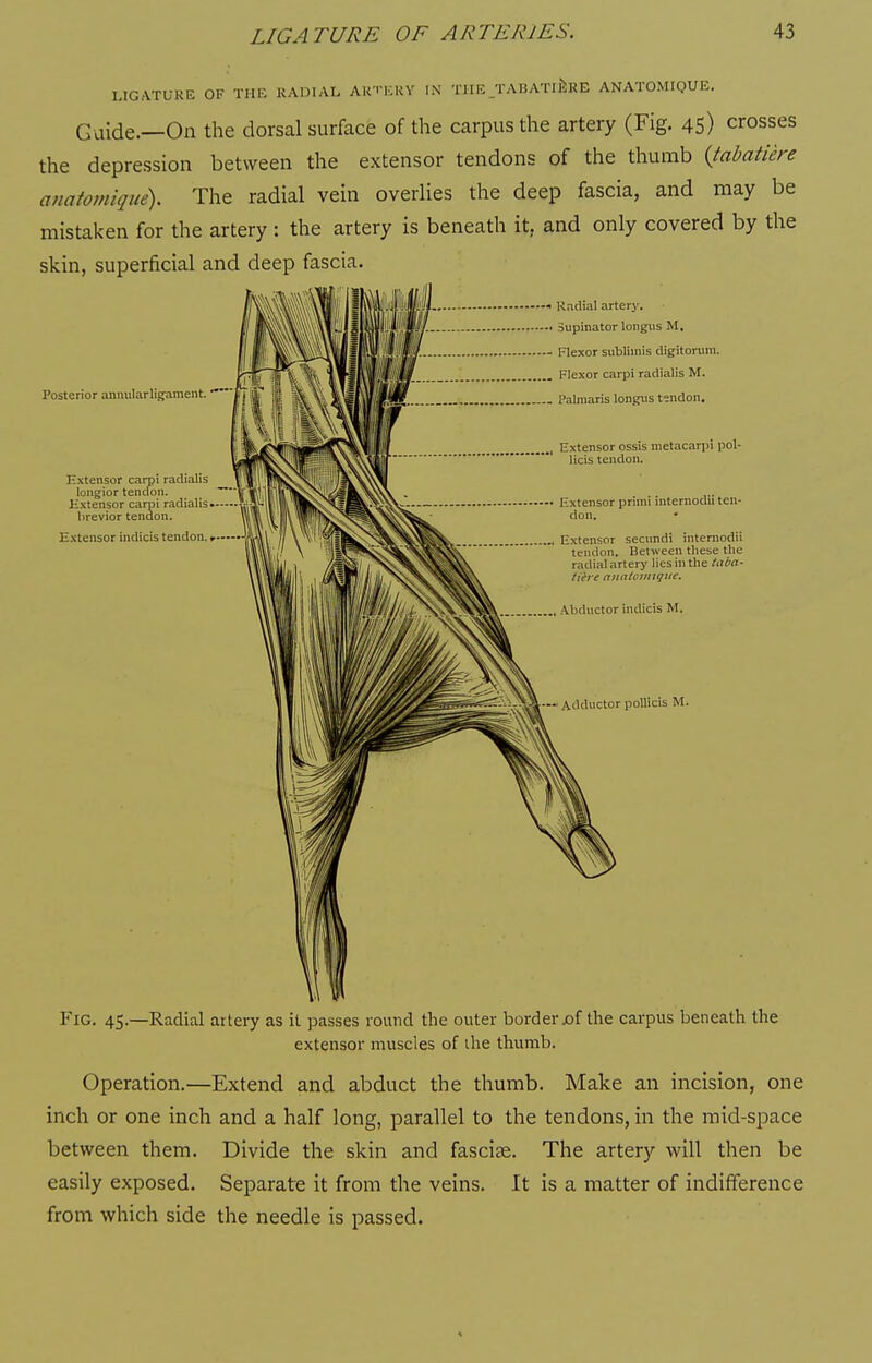 UGATURE OF THE RADIAL Aim-.UY IN THE;rABATlijRE ANATOMIQUE. Guide.—On the dorsal surface of the carpus the artery (Fig. 45) crosses the depression between the extensor tendons of the thumb {tahatiere anatomique). The radial vein overlies the deep fascia, and may be mistaken for the artery : the artery is beneath it, and only covered by the skin, superficial and deep fascia. Fig. 45.—Radial arteiy as it passes round the outer border jof the carpus beneath the extensor muscles of ihe thumb. Operation.—Extend and abduct the thumb. Make an incision, one inch or one inch and a half long, parallel to the tendons, in the mid-space between them. Divide the skin and fasciae. The artery will then be easily exposed. Separate it from the veins. It is a matter of indifference from which side the needle is passed.