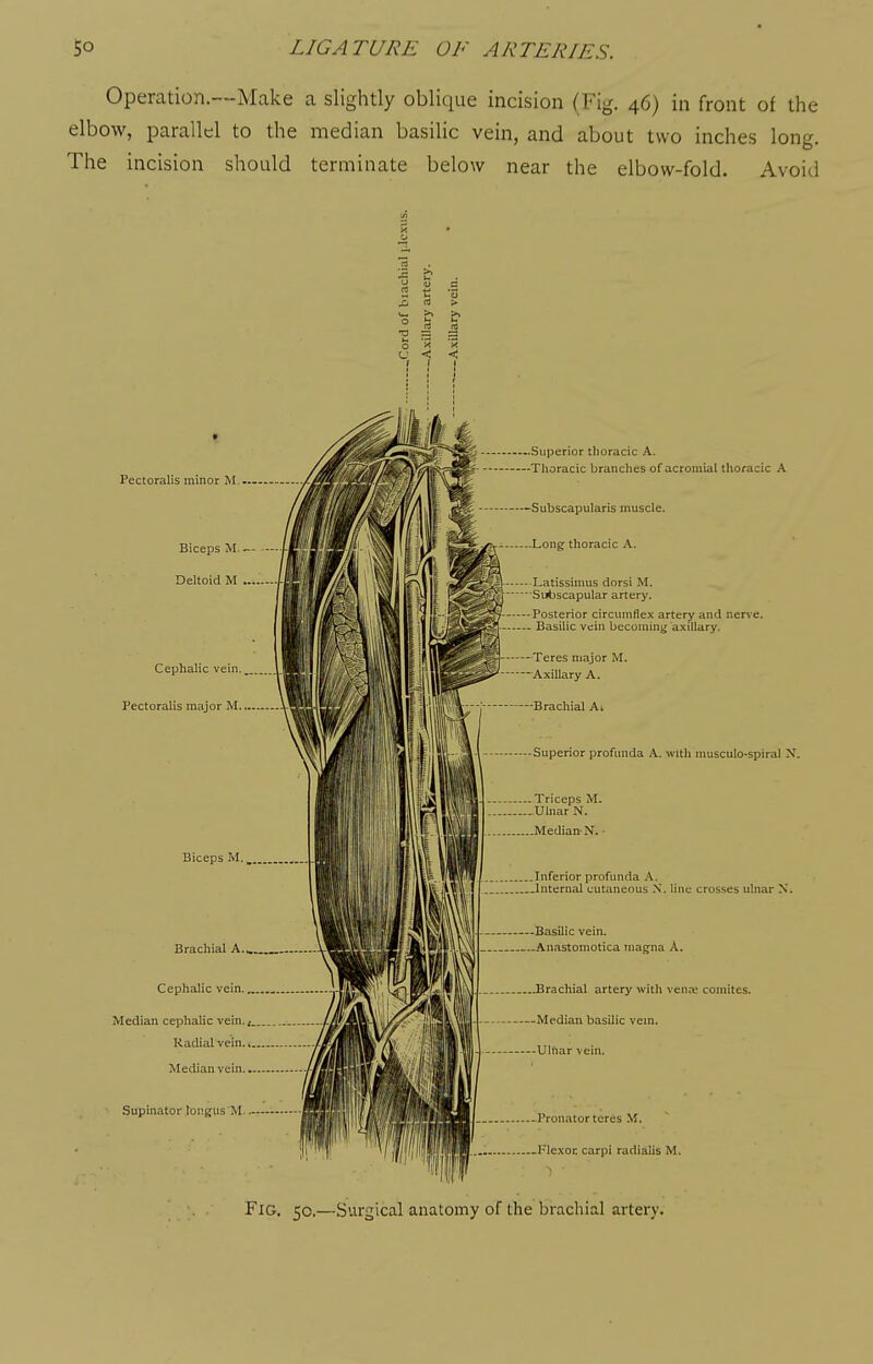 Operation.—Make a slightly oblique incision (Fig. 46) in front of the elbow, parallel to the median basilic vein, and about two inches long. The incision should terminate below near the elbow-fold. Avoid Pectoralis minor M. Biceps M.- Deltoid M Cephalic vein. Pectoralis major M. Biceps M. Brachial A. Cephalic vein. Median cephalic vein.^. Radial vein.* Median vein.. Supinator longus M- ^ Superior thoracic A. Thoracic branches of acromial thoracic A Subscapularis muscle. Long' thoracic A. Latissimus dorsi M. Subscapular artery. Posterior circumflex artery and nerve. Basilic vein becoming axillary. Teres major M. Axillary A. Brachial A* Superior profunda A. with musculo-spiral N, Triceps M. Ulnar N. Median* N. - Inferior profunda A. Internal cutaneous N, line crosses ulnar N. Basilic vein. Anastomotica mag^na A. Brachial artery witli venai comites. Median basilic vem. Ulnar vein. Pronator teres M. .Flexoc carpi radialis M. Fig, 50.—Surgical anatomy of the brachial artery.