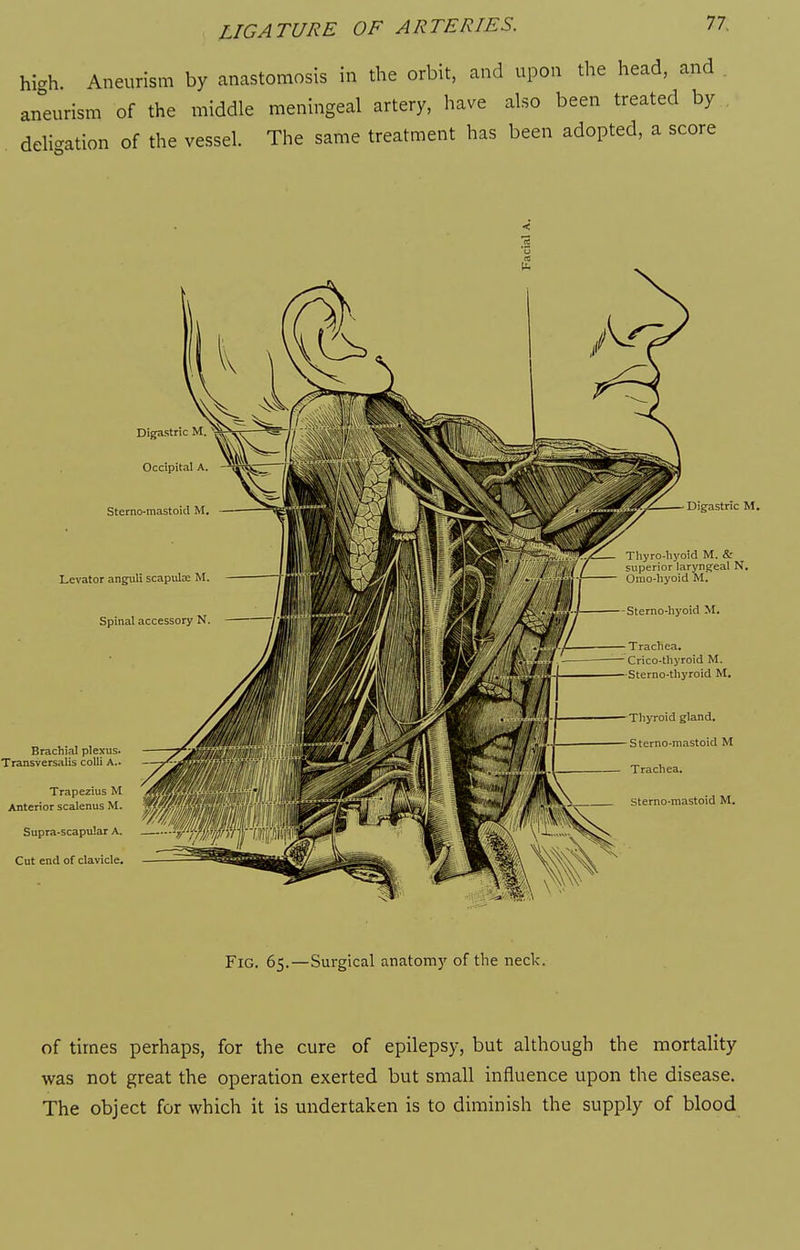 hic^h. Aneurism by anastomosis in the orbit, and upon the head, and aneurism of the middle meningeal artery, have also been treated by dehc^ation of the vessel. The same treatment has been adopted, a score of times perhaps, for the cure of epilepsy, but although the mortality was not great the operation exerted but small influence upon the disease. The object for which it is undertaken is to diminish the supply of blood