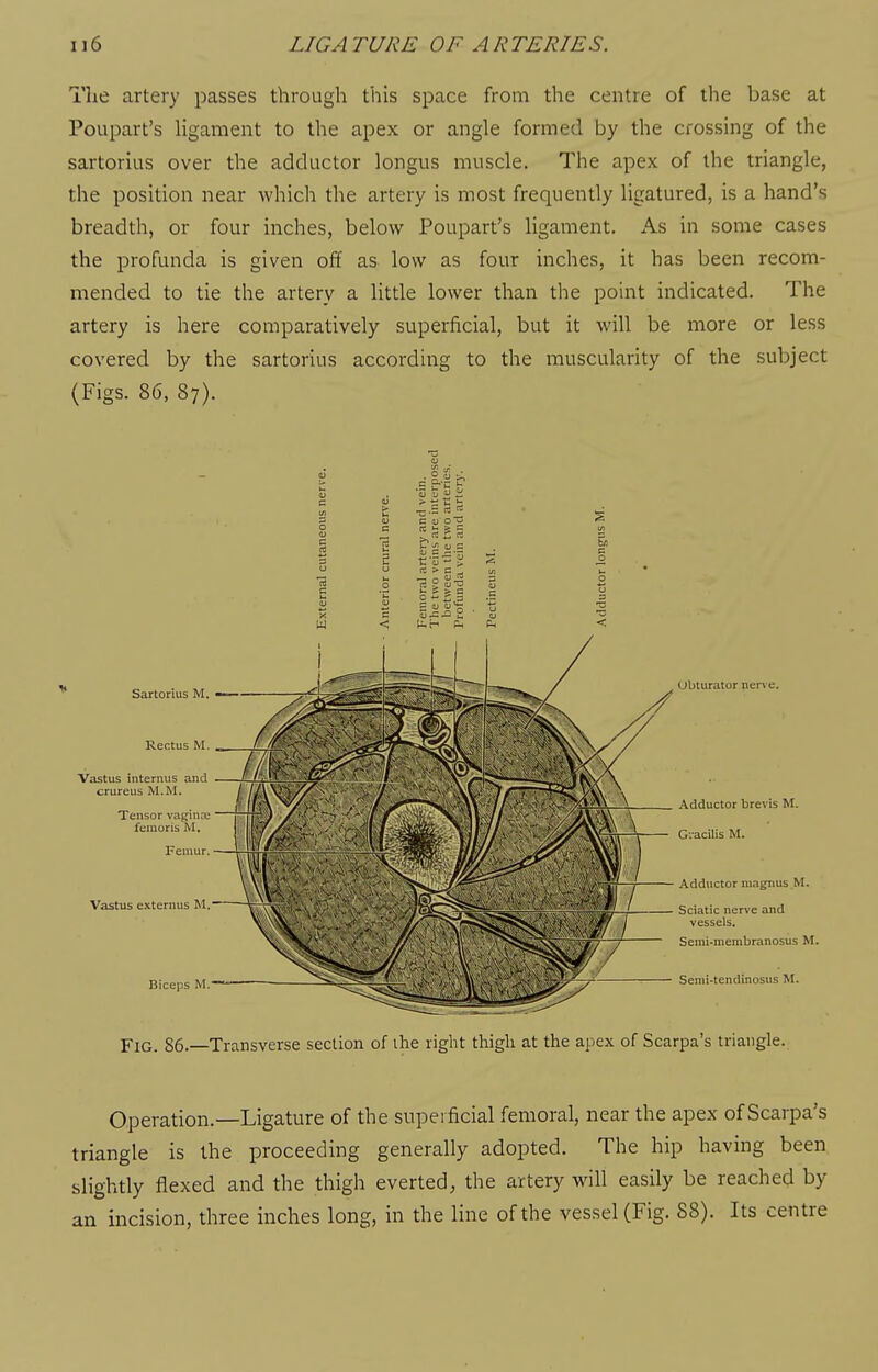 The artery passes through this space from the centre of the base at Poupart's Ugament to the apex or angle formed by the crossing of the sartorius over the adductor longus muscle. The apex of the triangle, the position near which the artery is most frequently ligatured, is a hand's breadth, or four inches, below Poupart's ligament. As in some cases the profunda is given off as low as four inches, it has been recom- mended to tie the artery a little lower than the point indicated. The artery is here comparatively superficial, but it will be more or less covered by the sartorius according to the muscularity of the subject (Figs. 86, 87). Sartorius M, Rectus M _ Vastus intemus and ' ■ IL__„JL< crureus M.M. ^ Tensor vaginaj feinoris M. Femur. Vastus externus M. Biceps M. Obturator nen c. Adductor brevis M. Gracilis M. Adductor niagnus.M. Sciatic nerve and vessels. Seini-membranosus M. Senii-tendinosus M. Fig. 86.—Transverse section of ihe right tliigli at the apex of Scarpa's triangle. Operation.—Ligature of the superficial femoral, near the apex of Scarpa's triangle is the proceeding generally adopted. The hip having been slightly flexed and the thigh everted, the artery will easily be reached by an incision, three inches long, in the line of the vessel (Fig. 88). Its centre