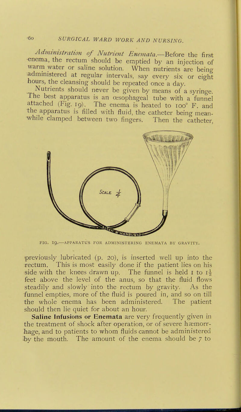 Administration of Nutrient Enetnata.—BcioYe the first enema, the rectum should be emptied by an injection of warm water or saline solution. When nutrients are being administered at regular intervals, say every six or eight hours, the cleansing should be repeated once a day. Nutrients should never be given by means of a syringe. The best apparatus is an oesophageal tube with a funnel attached (Fig. 19). The enema is heated to 100° F. and the apparatus is filled with fluid, the catheter being mean- while clamped between two fingers. Then the catheter, FIG. 19.—APPARATUS FOR ADMINISTERING ENEMATA BV GRAVITY. previously lubricated (p. 20), is inserted well up into the rectum. This is most easily done if the patient lies on his side with the knees drawn up. The funnel is held i to feet above the level of the anus, so that the fluid flows steadily and slowly into the rectum by gravity. As the funnel empties, more of the fluid is poured in, and so on till the whole enema has been administered. The patient should then lie quiet for about an hour. Saline Infusions or Enemata are very frequently given in the treatment of shock after operation, or of severe haemorr- hage, and to patients to whom fluids cannot be administered ^by the mouth. The amount of the enema should be 7 to