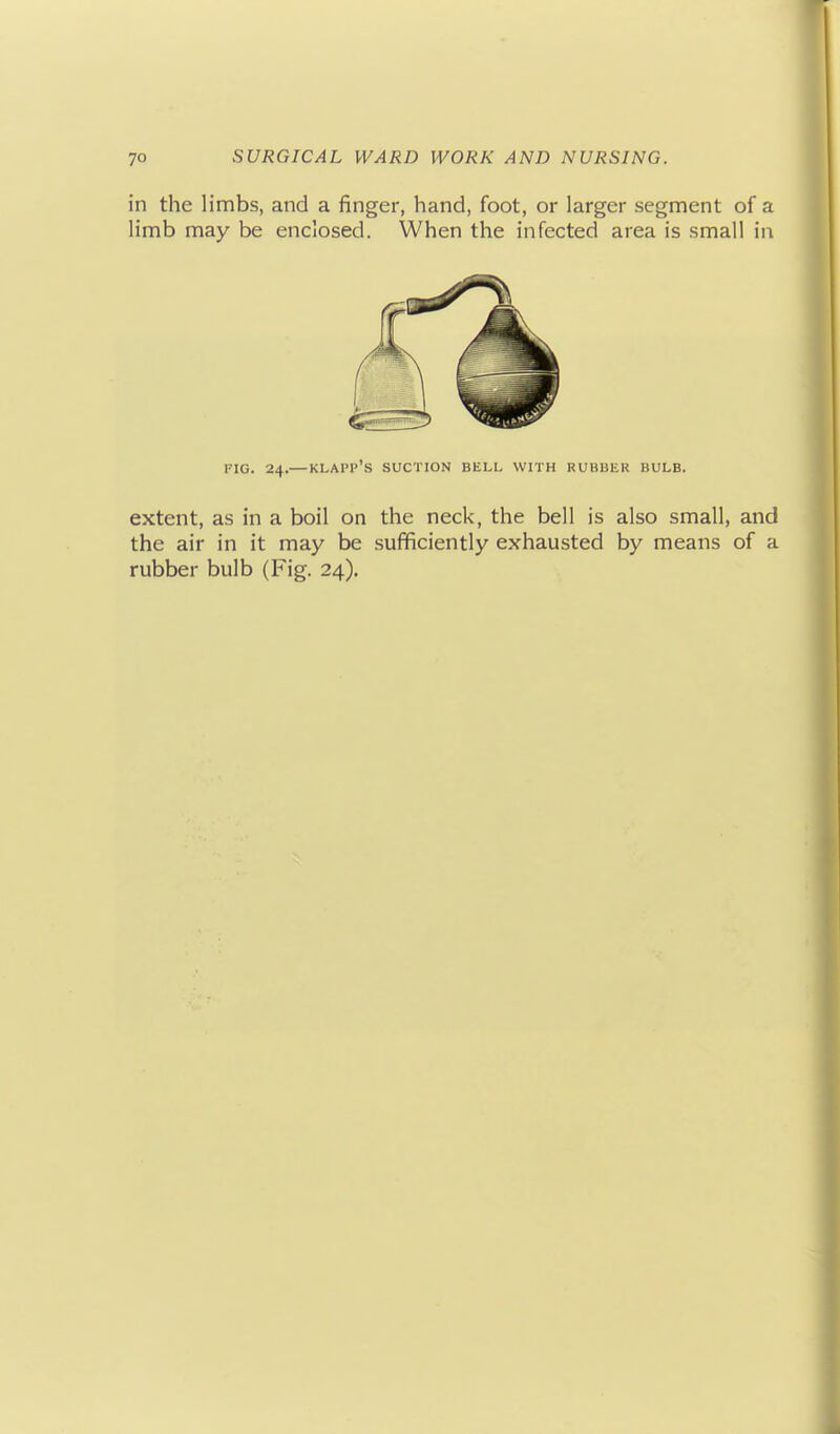 in the limbs, and a finger, hand, foot, or larger segment of a limb may be enclosed. When the infected area is small in FIG. 24.— KLAPP'S SUCTION BELL WITH RUBBER BULB. extent, as in a boil on the neck, the bell is also small, and the air in it may be sufficiently exhausted by means of a rubber bulb (Fig. 24).