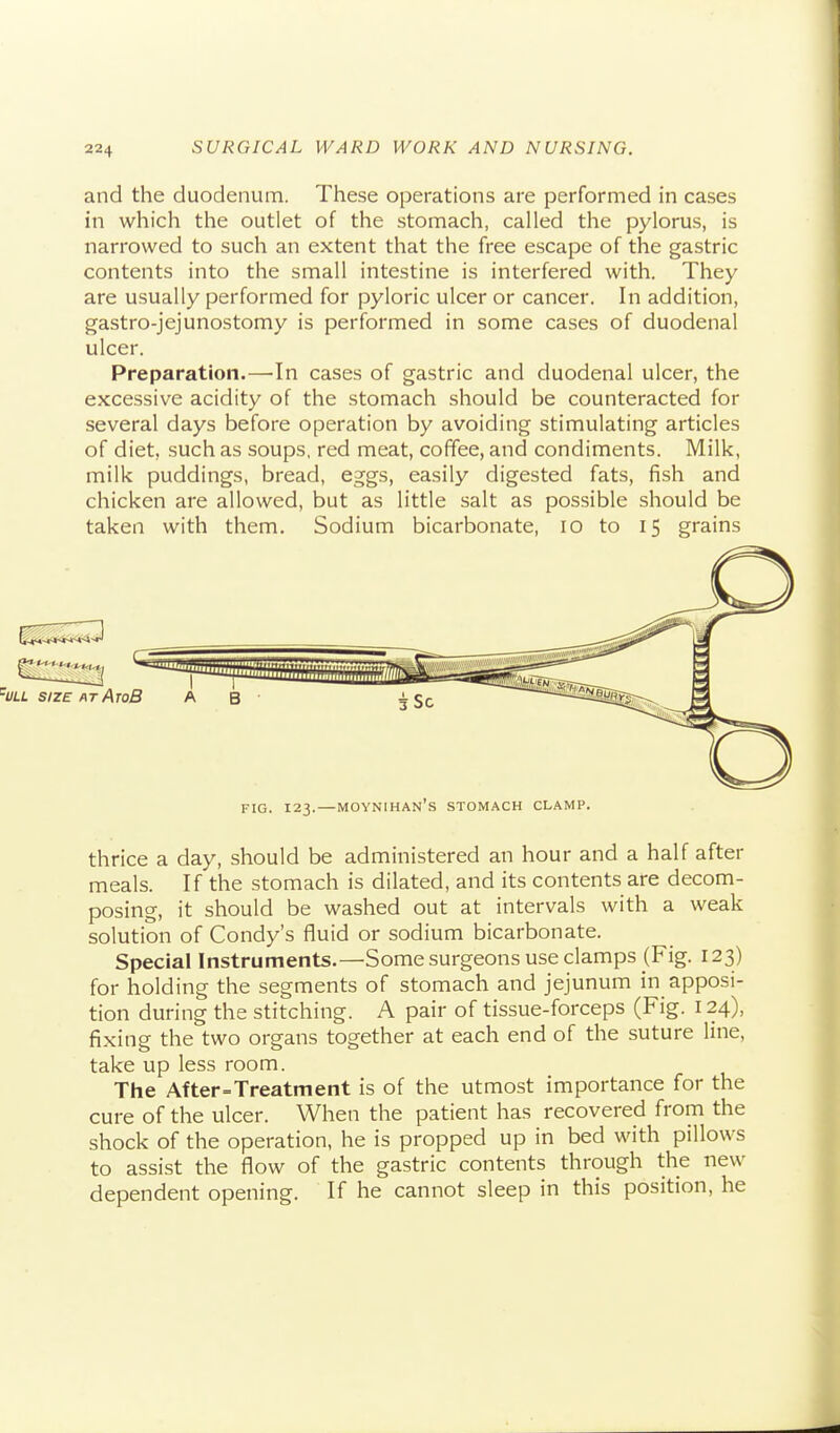 and the duodenum. These operations are performed in cases in which the outlet of the stomach, called the pylorus, is narrowed to such an extent that the free escape of the gastric contents into the small intestine is interfered with. They are usually performed for pyloric ulcer or cancer. In addition, gastro-jejunostomy is performed in some cases of duodenal ulcer. Preparation.—In cases of gastric and duodenal ulcer, the excessive acidity of the stomach should be counteracted for several days before operation by avoiding stimulating articles of diet, such as soups, red meat, coffee, and condiments. Milk, milk puddings, bread, eggs, easily digested fats, fish and chicken are allowed, but as little salt as possible should be taken with them. Sodium bicarbonate, lo to 15 grains FIG. 123. — MOYNIHAN's stomach CLAMP. thrice a day, should be administered an hour and a half after meals. If the stomach is dilated, and its contents are decom- posing, it should be washed out at intervals with a weak solution of Condy's fluid or sodium bicarbonate. Special Instruments.—Some surgeons use clamps (Fig. 123) for holding the segments of stomach and jejunum in apposi- tion during the stitching. A pair of tissue-forceps (Fig. 124), fixing the two organs together at each end of the suture line, take up less room. The After Treatment is of the utmost importance for the cure of the ulcer. When the patient has recovered from the shock of the operation, he is propped up in bed with pillows to assist the flow of the gastric contents through the new dependent opening. If he cannot sleep in this position, he
