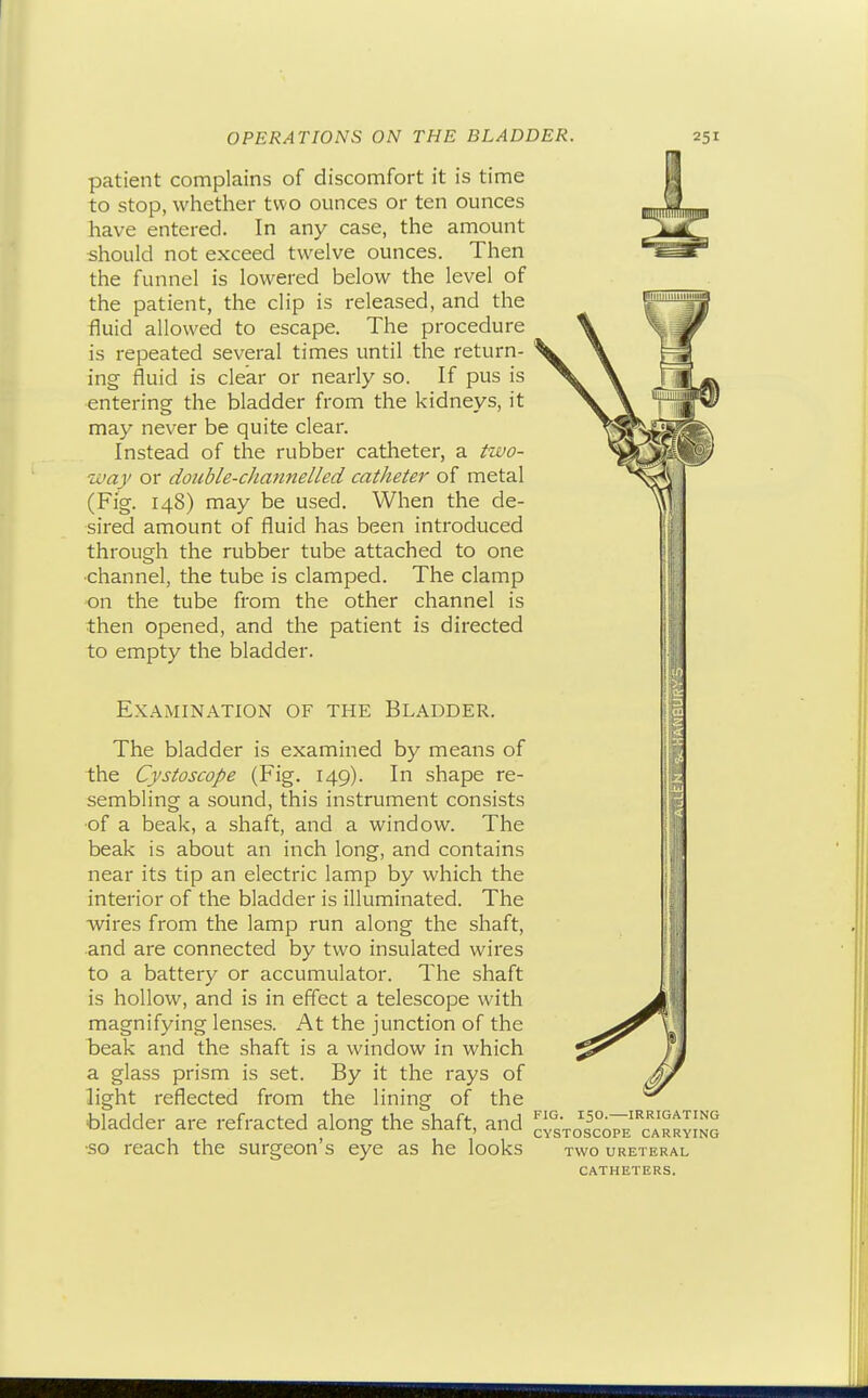 patient complains of discomfort it is time to stop, whether two ounces or ten ounces have entered. In any case, the amount should not exceed twelve ounces. Then the funnel is lowered below the level of the patient, the clip is released, and the fluid allowed to escape. The procedure is repeated several times until the return- ing fluid is clear or nearly so. If pus is entering the bladder from the kidneys, it may never be quite clear. Instead of the rubber catheter, a two- way or double-channelled catheter of metal (Fig. 148) may be used. When the de- sired amount of fluid has been introduced through the rubber tube attached to one ■channel, the tube is clamped. The clamp on the tube from the other channel is then opened, and the patient is directed to empty the bladder. Examination of the Bladder. The bladder is examined by means of the Cystoscope (Fig. 149). In shape re- sembling a sound, this instrument consists ■of a beak, a shaft, and a window. The beak is about an inch long, and contains near its tip an electric lamp by which the interior of the bladder is illuminated. The wires from the lamp run along the shaft, and are connected by two insulated wires to a battery or accumulator. The shaft is hollow, and is in effect a telescope with magnifying lenses. At the junction of the beak and the shaft is a window in which a glass prism is set. By it the rays of light reflected from the lining of the bladder are refracted along the shaft, and •so reach the surgeon's eye as he looks 111 FIG. 150.—IRRIGATING CYSTOSCOPE CARRYING TWO URETERAL