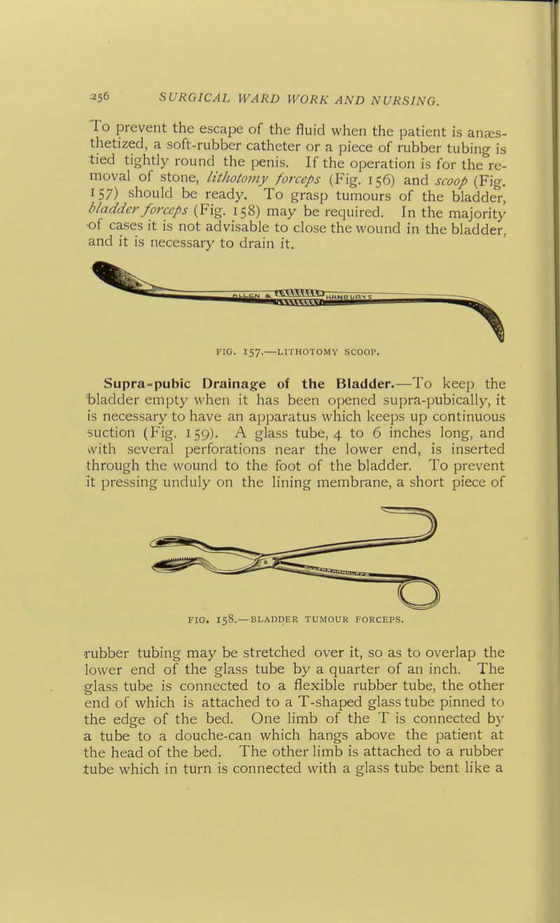 To prevent the escape of the fluid when the patient is anes- thetized, a soft-rubber catheter or a piece of rubber tubing is tied tighdy round the penis. If the operation is for the re- moval of stone, lithotomy forceps (Fig. 156) and scoop (Fig. 157) should be ready. To grasp tumours of the bladder, bladder forceps (Fig. 158) may be required. In the majority ■of cases it is not advisable to close the wound in the bladder, and it is necessary to drain it. FIG. 157.—LITHOTOMY SCOOP. Supra=pubic Drainage of the Bladder.—To keep the 'bladder empty when it has been opened supra-pubically, it is necessary to have an apparatus which keeps up continuous suction (Fig. 159). A glass tube, 4 to 6 inches long, and ^vith several perforations near the lower end, is inserted through the wound to the foot of the bladder. To prevent it pressing unduly on the lining membrane, a short piece of FIG. 158. — BLADDER TUMOUR FORCEPS. rubber tubing may be stretched over it, so as to overlap the lower end of the glass tube by a quarter of an inch. The glass tube is connected to a flexible rubber tube, the other end of which is attached to a T-shaped glass tube pinned to the edge of the bed. One limb of the T is connected by a tube to a douche-can which hangs above the patient at the head of the bed. The other limb is attached to a rubber tube which in turn is connected with a glass tube bent like a