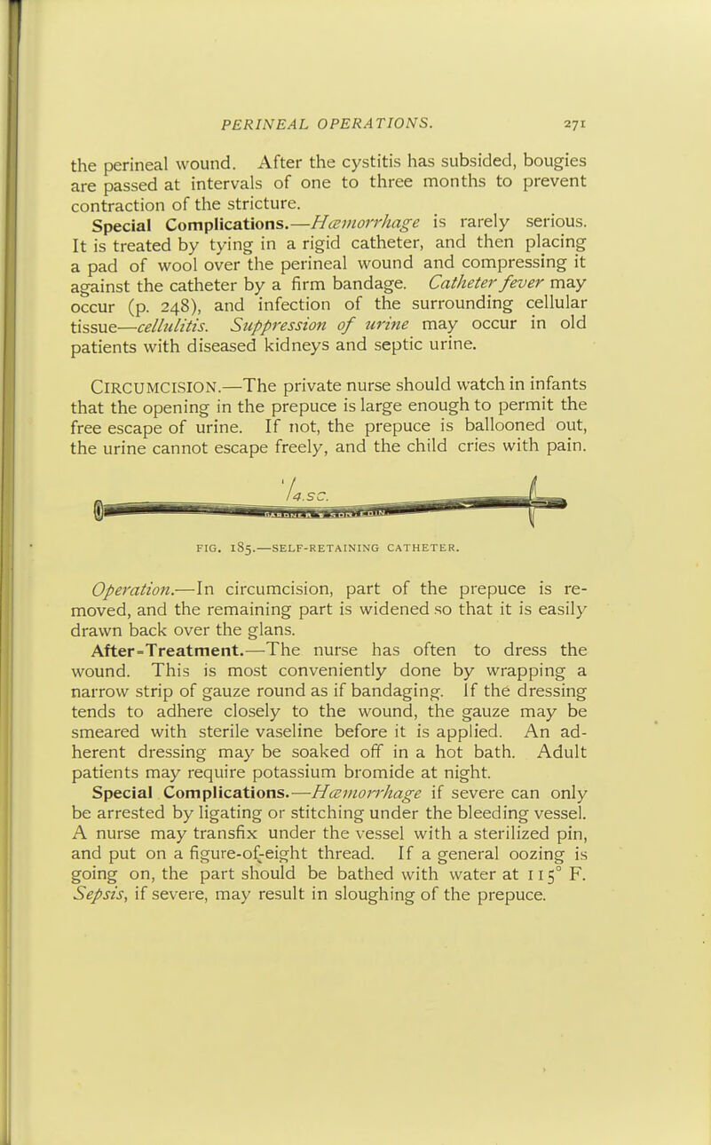 the perineal wound. After the cystitis has subsided, bougies are passed at intervals of one to three months to prevent contraction of the stricture. Special Complications.—Hceinorrhage is rarely serious. It is treated by tying in a rigid catheter, and then placing a pad of wool over the perineal wound and compressing it against the catheter by a firm bandage. Catheter fever may occur (p. 248), and infection of the surrounding cellular tissue—celliilitis. Suppression of urine may occur in old patients with diseased kidneys and septic urine. Circumcision.—The private nurse should watch in infants that the opening in the prepuce is large enough to permit the free escape of urine. If not, the prepuce is ballooned out, the urine cannot escape freely, and the child cries with pain. FIG. 185.—SELF-RETAINING CATHETER. Operation.—In circumcision, part of the prepuce is re- moved, and the remaining part is widened so that it is easily drawn back over the glans. After=Treatment.^—^The nurse has often to dress the wound. This is most conveniently done by wrapping a narrow strip of gauze round as if bandaging. If the dressing tends to adhere closely to the wound, the gauze may be smeared with sterile vaseline before it is applied. An ad- herent dressing may be soaked off in a hot bath. Adult patients may require potassium bromide at night. Special Complications.—HcBinon'hage if severe can only be arrested by ligating or stitching under the bleeding vessel. A nurse may transfix under the vessel with a sterilized pin, and put on a figure-of-eight thread. If a general oozing is going on, the part should be bathed with water at 115° F. Sepsis, if severe, may result in sloughing of the prepuce.