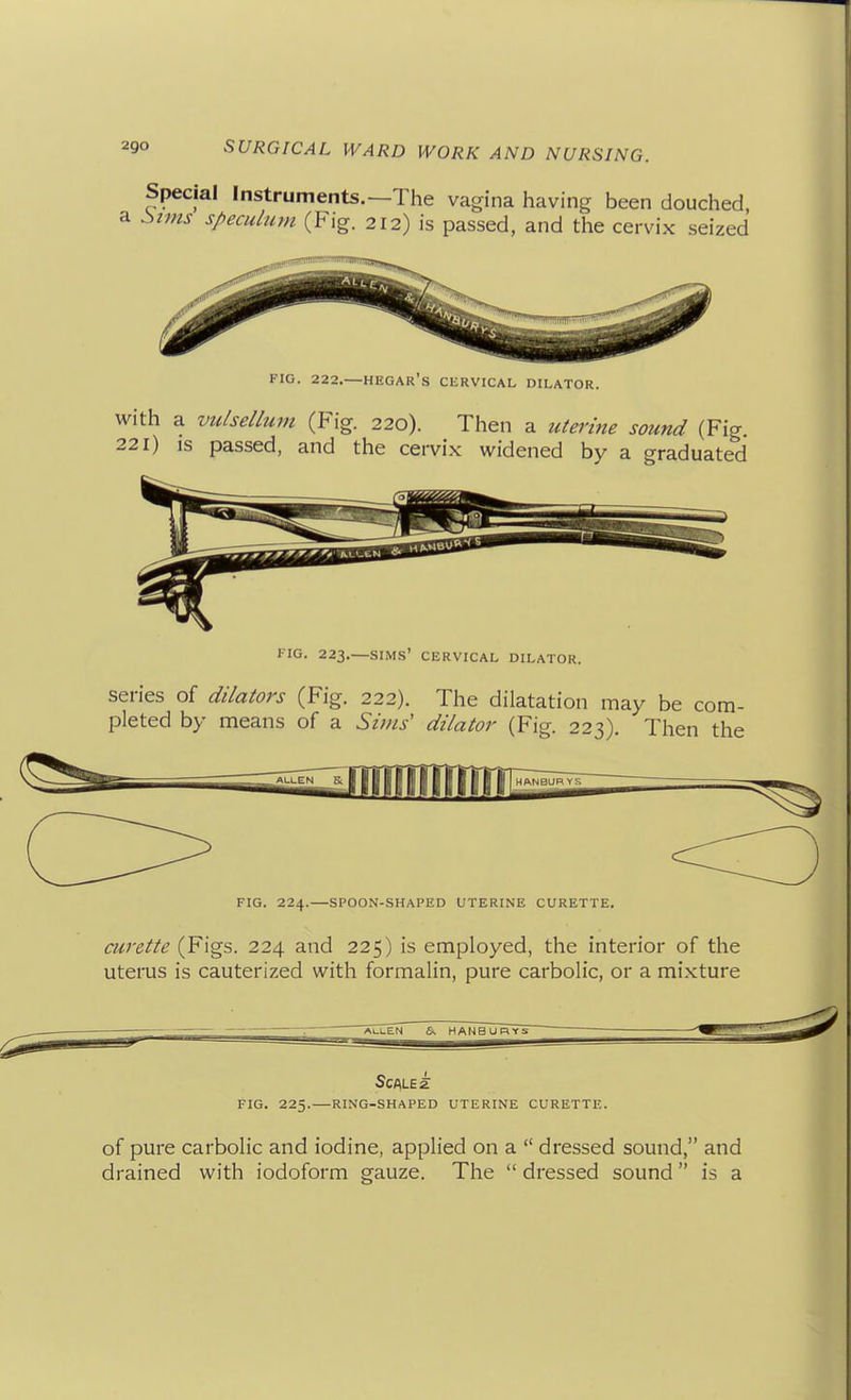 Special Instruments.—The vagina having been douched, Szms speculum (Fig. 212) is passed, and the cervix seized FIG. 222.—HEGAR's CERVICAL DILATOR. with a vulsellum (Fig. 220). Then a uterine sound (Fig 221) IS passed, and the cervix widened by a graduated FIG. 223.—SIM.S' CERVICAL DILATOR. series of dilators (Fig. 222). The dilatation may be com- pleted by means of a Sims' dilator (Fig. 223). Then the FIG. 224.—SPOON-SHAPED UTERINE CURETTE. curette (Figs. 224 and 225) is employed, the interior of the uterus is cauterized with formalin, pure carbolic, or a mixture AI.LEN 6. HANBURYS FIG. 225. — RING-SHAPED UTERINE CURETTE. of pure carbolic and iodine, applied on a  dressed sound, and drained with iodoform gauze. The  dressed sound is a