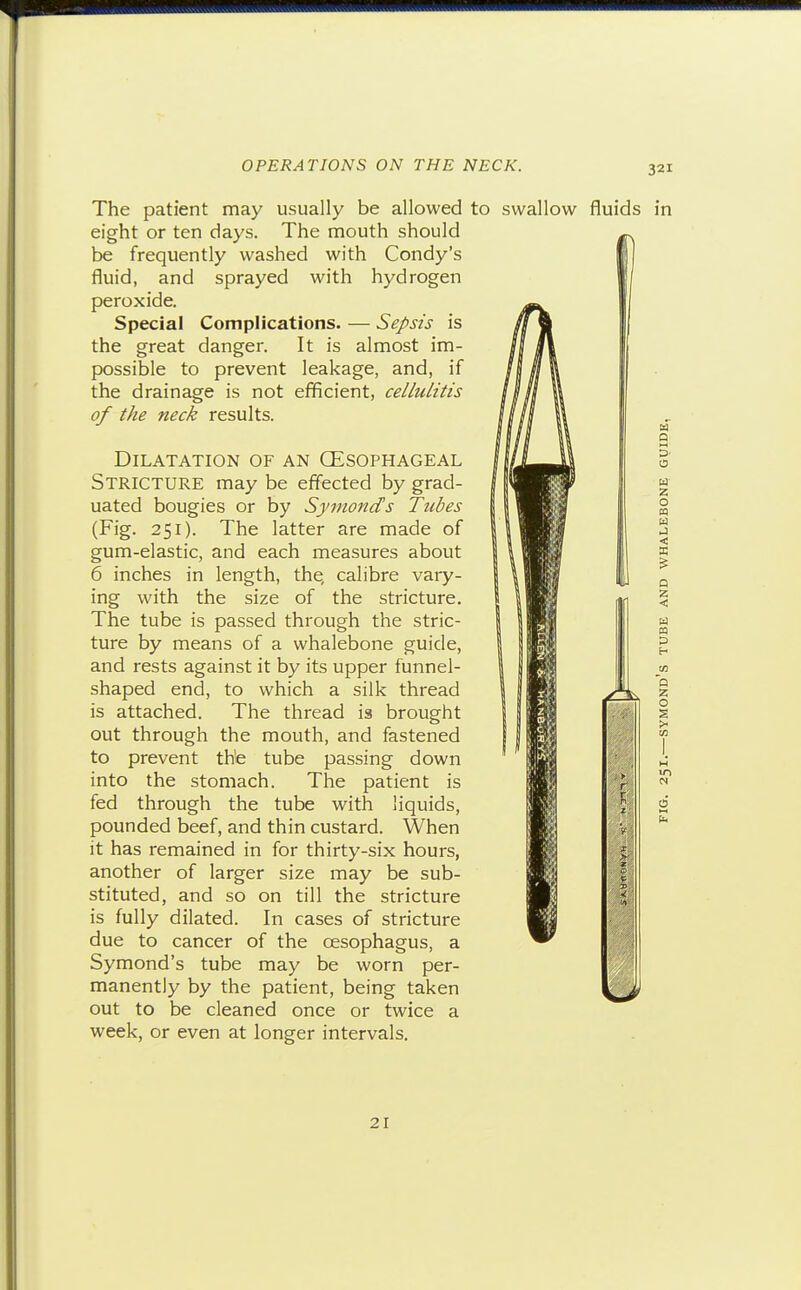 The patient may usually be allowed to swallow fluids eight or ten days. The mouth should be frequently washed with Condy's fluid, and sprayed with hydrogen peroxide. Special Complications. — Sepsis is the great danger. It is almost im- possible to prevent leakage, and, if the drainage is not efficient, cellulitis of the neck results. Dilatation of an GEsophageal Stricture may be effected by grad- uated bougies or by Symonds Tubes (Fig. 251). The latter are made of gum-elastic, and each measures about 6 inches in length, the, calibre vary- ing with the size of the stricture. The tube is passed through the stric- ture by means of a whalebone guide, and rests against it by its upper funnel- shaped end, to which a silk thread | ^| is attached. The thread is brought out through the mouth, and fastened to prevent the tube passing down into the stomach. The patient is fed through the tube with liquids, pounded beef, and thin custard. When it has remained in for thirty-six hours, another of larger size may be sub- stituted, and so on till the stricture is fully dilated. In cases of stricture due to cancer of the oesophagus, a Symond's tube may be worn per- manently by the patient, being taken out to be cleaned once or twice a week, or even at longer intervals. 21