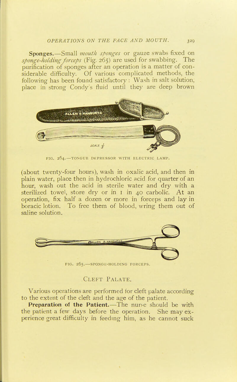 Sponges.—Small mouth sponges or gauze swabs fixed on sponge-holding forceps (Fig. 265) are used for swabbing. The purification of sponges after an operation is a matter of con- siderable difficulty. Of various complicated methods, the following has been found satisfactory : Wash in salt solution, place in strong Condy's fluid until they are deep brown FIG. 264.—TONGUE DEPRESSOR WITH ELECTRIC LAMP. (about twenty-four hours), wash in oxalic acid, and then in plain water, place then in hydrochloric acid for quarter of an hour, wash out the acid in sterile water and dry with a sterilized towel, store dry or in i in 40 carbolic. At an operation, fix half a dozen or more in forceps and lay in boracic lotion. To free them of blood, wring them out of saline solution. FIG. 265.—SPONGE-HOLDING FORCEPS. Cleft Palate. Various operations are performed for cleft palate according to the extent of the cleft and the age of the patient. Preparation of the Patient.—The nurse should be with the patient a few days before the operation. She may ex- perience great difficulty in feedmg him, as he cannot suck