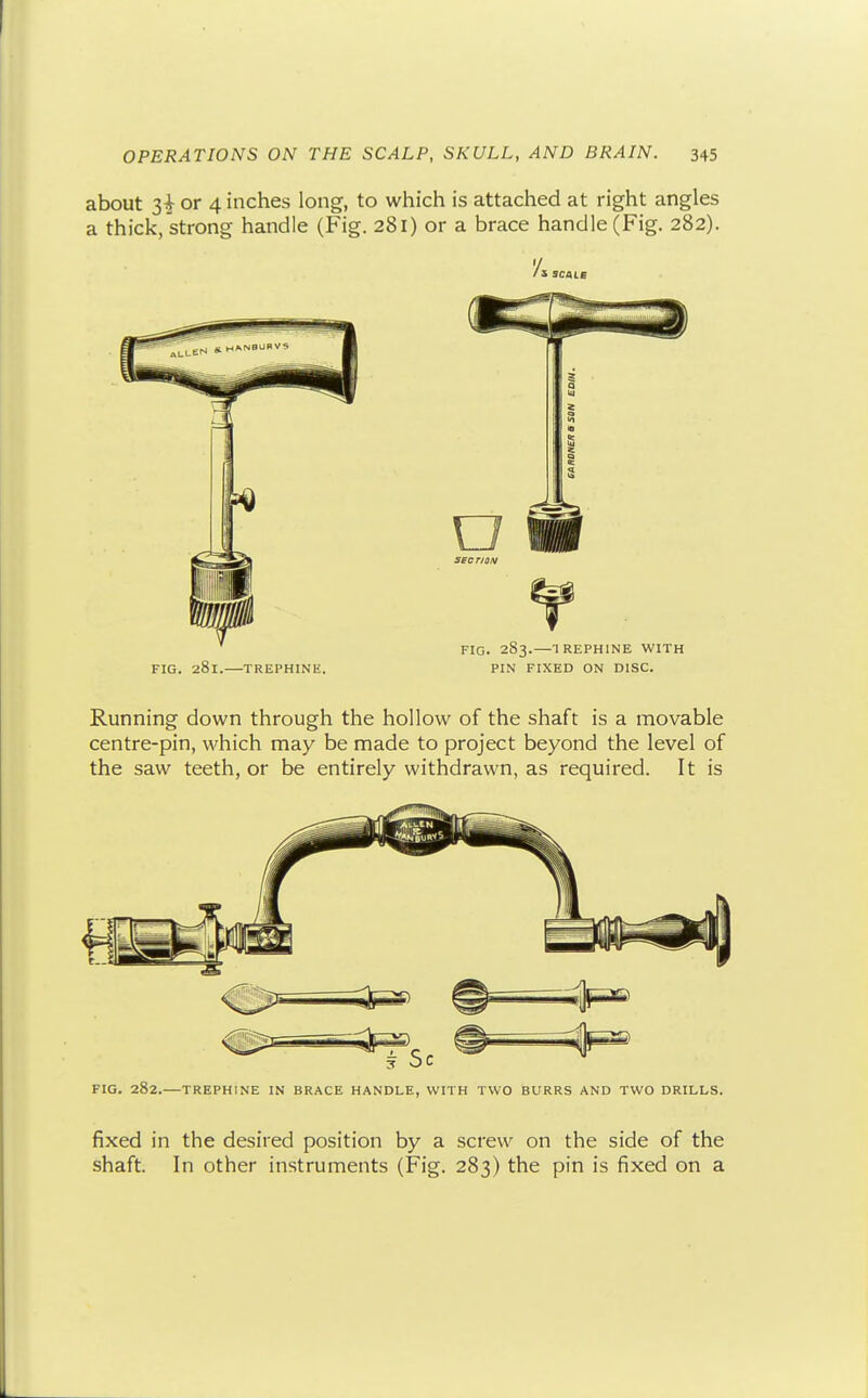 about 3i or 4 inches long, to which is attached at right angles a thick.'strong handle (Fig. 281) or a brace handle (Fig. 282). X SCALE FIG. 281.—TREPHINE. FIG. 283.—TREPHINE WITH PIN FIXED ON DISC. Running down through the hollow of the shaft is a movable centre-pin, which may be made to project beyond the level of the saw teeth, or be entirely withdrawn, as required. It is FIG. 282.—TREPHINE IN BRACE HANDLE, WITH TWO BURRS AND TWO DRILLS. fixed in the desired position by a screw on the side of the shaft. In other instruments (Fig. 283) the pin is fixed on a