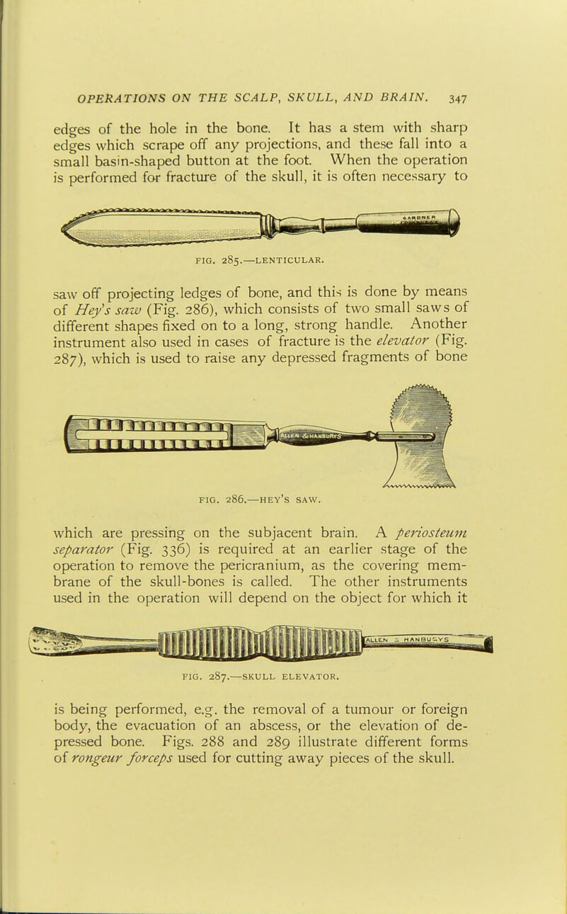 edges of the hole in the bone. It has a stem with sharp edges which scrape off any projections, and these fall into a small basin-shaped button at the foot. When the operation is performed for fracture of the skull, it is often necessary to FIG. 285.—LENTICULAR. saw off projecting ledges of bone, and this is done by means of Hej/'s saw (Fig. 286), which consists of two small saws of different shapes fixed on to a long, strong handle. Another instrument also used in cases of fracture is the elevator (Fig. 287), which is used to raise any depressed fragments of bone FIG. 286.—key's saw. which are pressing on the subjacent brain. A periosteum separator (Fig. 336) is required at an earlier stage of the operation to remove the pericranium, as the covering mem- brane of the skull-bones is called. The other instruments used in the operation will depend on the object for which it FIG. 287.—SKULL ELEVATOR. is being performed, e.g. the removal of a tumour or foreign body, the evacuation of an abscess, or the elevation of de- pressed bone. Figs. 288 and 289 illustrate different forms of rongeur forceps used for cutting away pieces of the skull.