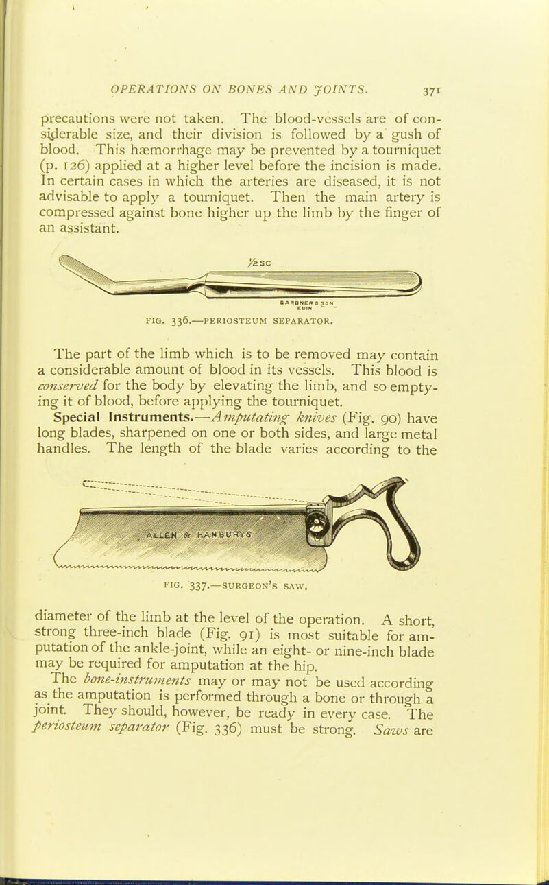 precautions were not taken. The blood-vessels are of con- syjerable size, and their division is followed by a gush of blood. This haemorrhage may be prevented by a tourniquet (p. 126) applied at a higher level before the incision is made. In certain cases in which the arteries are diseased, it is not advisable to apply a tourniquet. Then the main artery is compressed against bone higher up the limb by the finger of an assistant. The part of the limb which is to be removed may contain a considerable amount of blood in its vessels. This blood is conserved for the body by elevating the limb, and so empty- ing it of blood, before applying the tourniquet. Special Instruments.—Amputating knives (Fig. 90) have long blades, sharpened on one or both sides, and large metal handles. The length of the blade varies according to the diameter of the limb at the level of the operation. A short, strong three-inch blade (Fig. 91) is most suitable for am- putation of the ankle-joint, while an eight- or nine-inch blade may be required for amputation at the hip. The bone-instruments may or may not be used according as the amputation is performed through a bone or through a joint. They should, however, be ready in every case. The periosteum separator (Fig. 336) must be strong. Saws are FIG. 336. PERIOSTEUM SEPARATOR. I'lG- 337-—surgeon's saw.