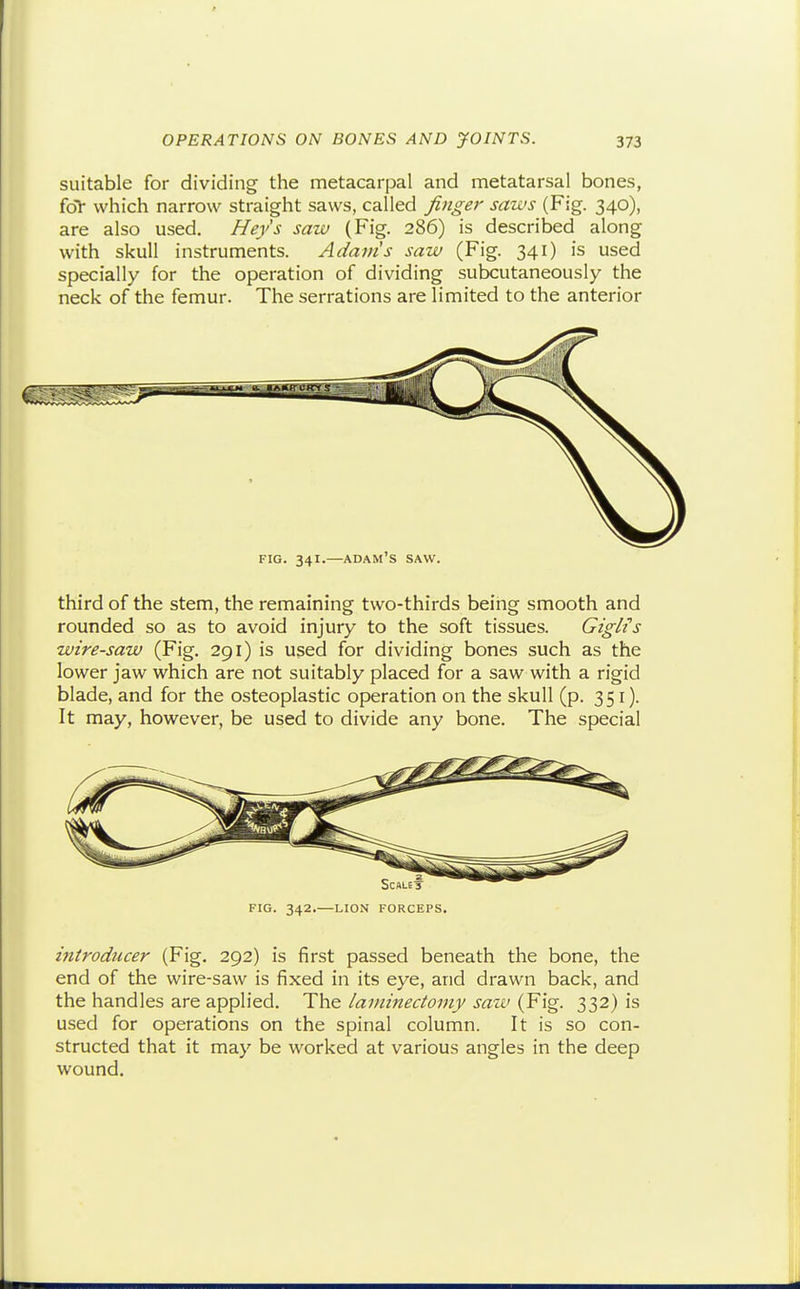 suitable for dividing the metacarpal and metatarsal bones, fol- which narrow straight saws, called finger saws (Fig. 340), are also used. Hey's saw (Fig. 286) is described along with skull instruments. Adains saw (Fig. 341) is used specially for the operation of dividing subcutaneously the neck of the femur. The serrations are limited to the anterior FIG. 341.—Adam's saw. third of the stem, the remaining two-thirds being smooth and rounded so as to avoid injury to the soft tissues. Giglis wire-saw (Fig. 291) is used for dividing bones such as the lower jaw which are not suitably placed for a saw with a rigid blade, and for the osteoplastic operation on the skull (p. 351). It may, however, be used to divide any bone. The special FIG. 342.—LION FORCEPS, introducer (Fig. 292) is first passed beneath the bone, the end of the wire-saw is fixed in its eye, and drawn back, and the handles are applied. The laminectomy saw (Fig. 332) is used for operations on the spinal column. It is so con- structed that it may be worked at various angles in the deep wound.