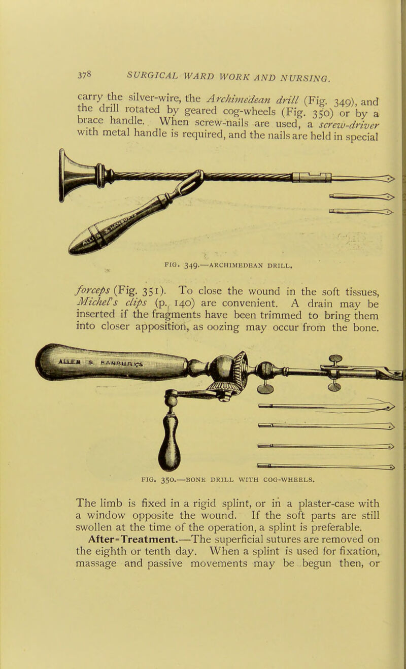 carry the silver-wire, the Archimedean drill (Fig. 349) and the drill rotated by geared cog-wheels (Fig. 350) or by a brace handle. When screw-nails are used, a screw-driver with metal handle is required, and the nails are held in special FIG. 349.—ARCHIMEDEAN DRILL. forceps {¥ig. 351). To close the wound in the soft tissues, Michel's clips (p.^ 140) are convenient. A drain may be inserted if the fragments have been trimmed to bring them into closer apposition, as oozing may occur from the bone. 1> 2> :3> FIG. 350.—BONE DRILL WITH COG-WHEELS. The limb is fixed in a rigid splint, or in a plaster-case with a window opposite the wound. If the soft parts are still swollen at the time of the operation, a splint is preferable. After=Treatment.—The superficial sutures are removed on the eighth or tenth day. When a splint is used for fixation, massage and passive movements may be begun then, or