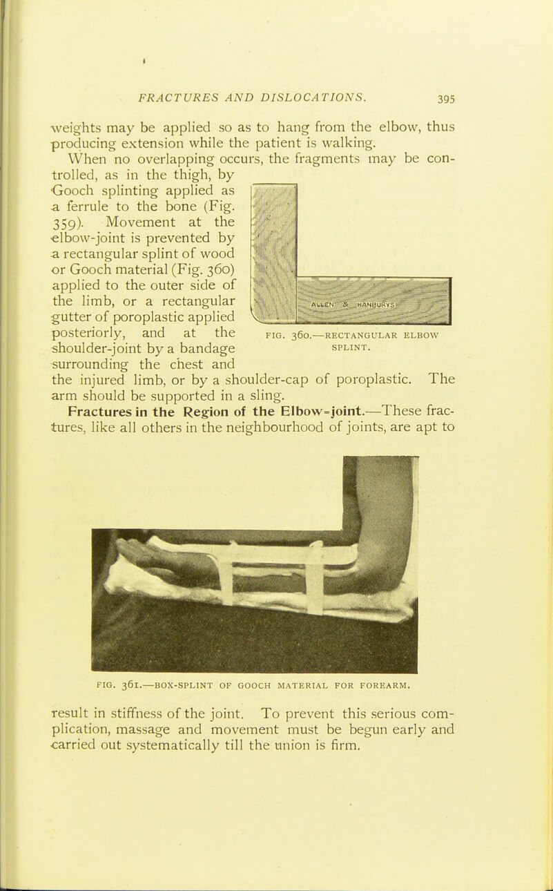 weights may be applied so as to hang from the elbow, thus producing extension while the patient is walking. VVhen no overlapping occurs, the fragments may be con- trolled, as in the thigh, by ■Gooch splinting applied as a ferrule to the bone (Fig. 359). Movement at the •elbow-joint is prevented by a rectangular splint of wood or Gooch material (Fig. 360) applied to the outer side of the limb, or a rectangular gutter of poroplastic applied ,iif5f«'|i|;ii;*f!l|!l| posteriorly, and at the fig. 360—rectangular elbow shoulder-joint by a bandage splint. surrounding the chest and the injured limb, or by a shoulder-cap of poroplastic. The arm should be supported in a sling. Fractures in the Region of the Elbow=joint.—These frac- tures, like all others in the neighbourhood of joints, are apt to FIG. 361.—BOX-SPLINT OF GOOCH MATERIAL FOR FOREARM. result in stiffness of the joint. To prevent this .serious com- plication, massage and movement must be begun early and carried out systematically till the union is firm.
