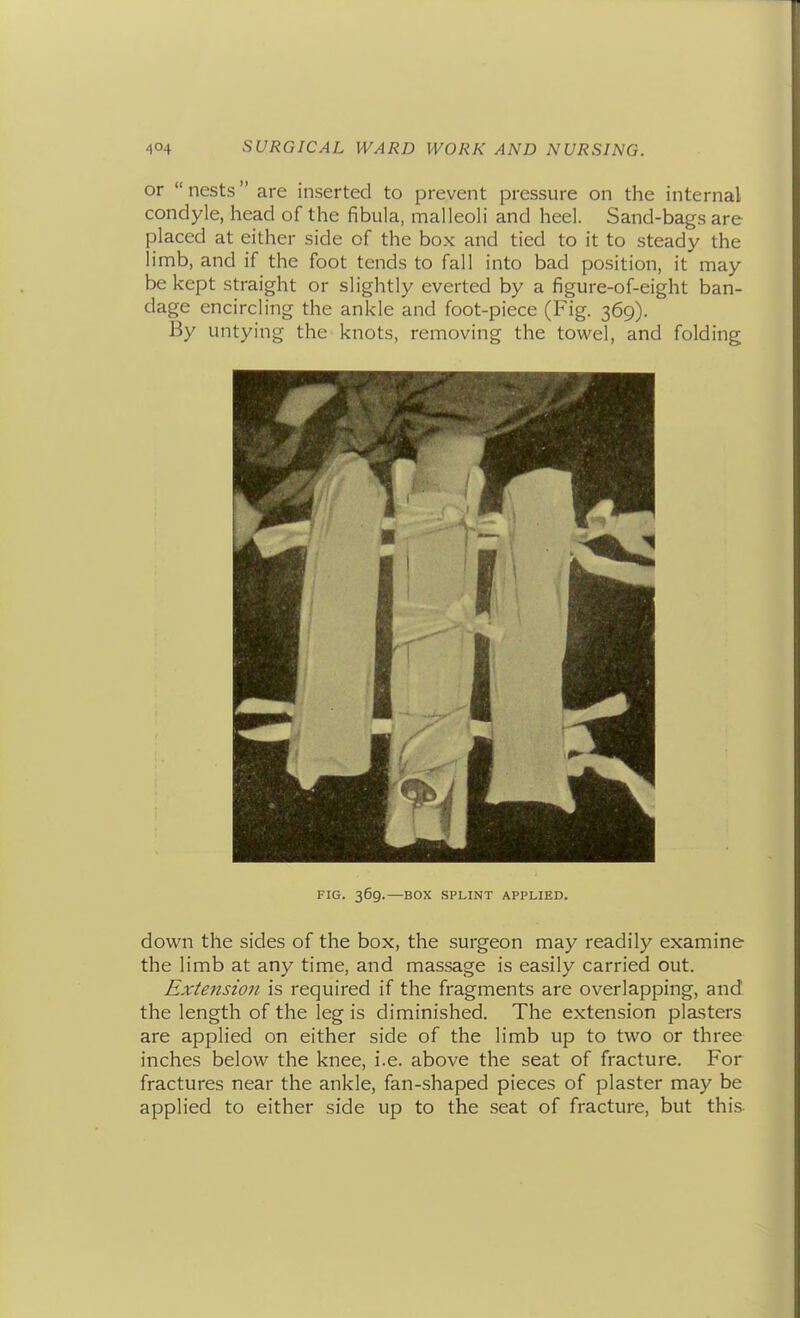 or  nests are inserted to prevent pressure on the internal condyle, head of the fibula, malleoli and heel. Sand-bags are placed at either side of the box and tied to it to steady the limb, and if the foot tends to fall into bad position, it may be kept straight or slightly everted by a figure-of-eight ban- dage encircling the ankle and foot-piece (Fig. 369). By untying the knots, removing the towel, and folding FIG. 369.—BOX SPLINT APPLIED. down the sides of the box, the surgeon may readily examine the limb at any time, and massage is easily carried out. Extension is required if the fragments are overlapping, and the length of the leg is diminished. The extension plasters are applied on either side of the limb up to two or three inches below the knee, i.e. above the seat of fracture. For fractures near the ankle, fan-shaped pieces of plaster may be applied to either side up to the seat of fracture, but this