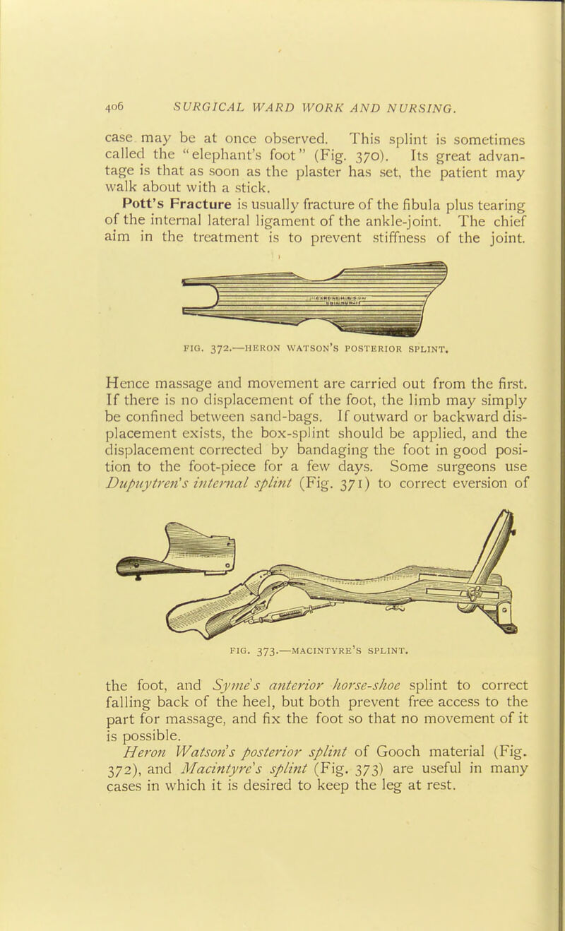 case may be at once observed. This splint is sometimes called the elephant's foot (Fig. 370). Its great advan- tage is that as soon as the plaster has set. the patient may walk about with a stick. Pott's Fracture is usually fracture of the fibula plus tearing of the internal lateral ligament of the ankle-joint. The chief aim in the treatment is to prevent .stiffness of the joint. FIG. 372.—HERON VVATS0N'.S POSTERIOR SPLINT. Hence massage and movement are carried out from the first. If there is no displacement of the foot, the limb may simply be confined between sand-bags. If outward or backward dis- placement exists, the box-splint should be applied, and the displacement corrected by bandaging the foot in good posi- tion to the foot-piece for a few days. Some surgeons use DupuytrerCs internal splint (Fig. 371) to correct eversion of FIG. 373.—MACINTYRE'S SPLINT. the foot, and Symes anterior horse-shoe splint to correct falling back of the heel, but both prevent free access to the part for massage, and fix the foot so that no movement of it is possible. Heron Watsons posterior splint of Gooch material (Fig. 372), and Macintyres splint (Fig. 373) are useful in many cases in which it is desired to keep the leg at rest.