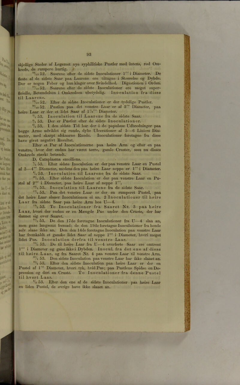 m r„. ler Postler. let laDjsonit ’ustel. Efier imil Saar, e Saar paa kosU-l e slaaet an. Arm era!- ladoneD A’r. ft boo^‘ •enitte Aim ), fatten® ^sen. Qelioar'^' ijr^etam Jjar 3®®^ bar jocti la,io« idi'i '.elf'. lor- skjellige Steder af Legemet nye sypliilitiske Fustier mecl intens, rod Om- ki-cds, de rumpere Inu’tig. *Vi5 52. Saarene efter de sidste Inoculationer 1' i Diameter. De fleste af de sidste Saar paa Laarene ere tiltagne i Storrelse og Dybde. Der er nogen Feber og bun klager over Svindelhed. Digestionen i Orden. ‘Vi2 52. Saai-ene efter de sidste Inoculationer ere meget super- ficielle, Betrendelsen i Omkredsen ubetydelig. Inoculation fra disse til Laarene. *Vi2 52. Efter de sidste Inoculationer er der tydelige Fustier. 52. Fustlen paa det venstre Laar er af 3' Diameter, paa Loire Laar er der et lidet Saar af lV2' Diameter. 'U 53. Inoculation til Laarene fra de sidste Saar. ■*/i 53. Der er Fustier efter de sidste Inoculationer. ®/i 53. I den sidste Tid liar der i de papulose Udbredninger paa begge Arme udviklet sig runde, dybe Ulcerationer af 5—6 Liniers Dia- meter, med skarpt afskaarne Rande. Inoculationer foretagne fra disse have givet negativt Resultat. Efter et Far af Inocuiationeme paa Loire Arm og efter en paa venstre, hvor der endnu har veeret torre, gamle Cruster, sees nu disses Omkreds staerkt betaendt. D. Cataplasma emoUiens. Vi 53. Efter sidste Inoculation er der paa venstre Laar en Fustel af 3—4' Diameter, medens den paa Loire Laar neppe er V i Diameter. % 53. Inoculation til Laarene fra de sidste Saar. 53. Efter sidste Inoculation er der paa venstre Laar en Fu- stel af i Diameter, paa Loire Laar af neppe 1'. **/i 53. Inoculation til Laarene fra de sidste Saar. ”/i 53. Faa det venstre Laar er der en rumperet Fustel, paa det Loire Laar slaaer Inoculationen ei an. 2 Inoculationer til Loire Laar fra sidste Saai’ paa Loire Arm Los U—4. 53. To Inoculationer fra Saaret Nr. 3 paa Loire Laar, Lvori der endnu er en Ma3ngde Fus under den Cruste, der Lar dannet sig over Saaret. *Vi 53. De den 17de foretagne Inoculationer fra U—4 slaa an, men gaae langsomt fremad; de den 19de foretagne Inoculationer fra bende selv slaae ikke an. Den den 14de foretagne Inoculation paa venstre Laar har fremkaldt et ganske Hdet Saar af neppe l'“ i Diameter, Lvori meget lidet Fus. Inoculation derfra til venstre Laax\ 'Vi 53. De til hoire Laar fra U—4 overforte Saar ere omtrent V i Diameter og gaaeikkei Dybden. Inociil. fra det ene af disse til hoire Laar, og fra Saaret Nr. 4 paa venstre Laar til venstre Arm. *Vi 53. Den sidste Inoculation paa venstre Laar har ikke slaaet an. 53. Efter den sidste Inoculation paa hoire Laar er der en Fustel af l'“ Diameter, hvori tyk, hvidFus; paa Fustlens Spidse en De- pression og deri en Cruste. To Inoculationer fra denne Fustel til hvert Laar. 53. Efter den ene af de sidste Inoculationer paa Loire Laar en liden Fustel, de ovrige have ikke slaaet an.