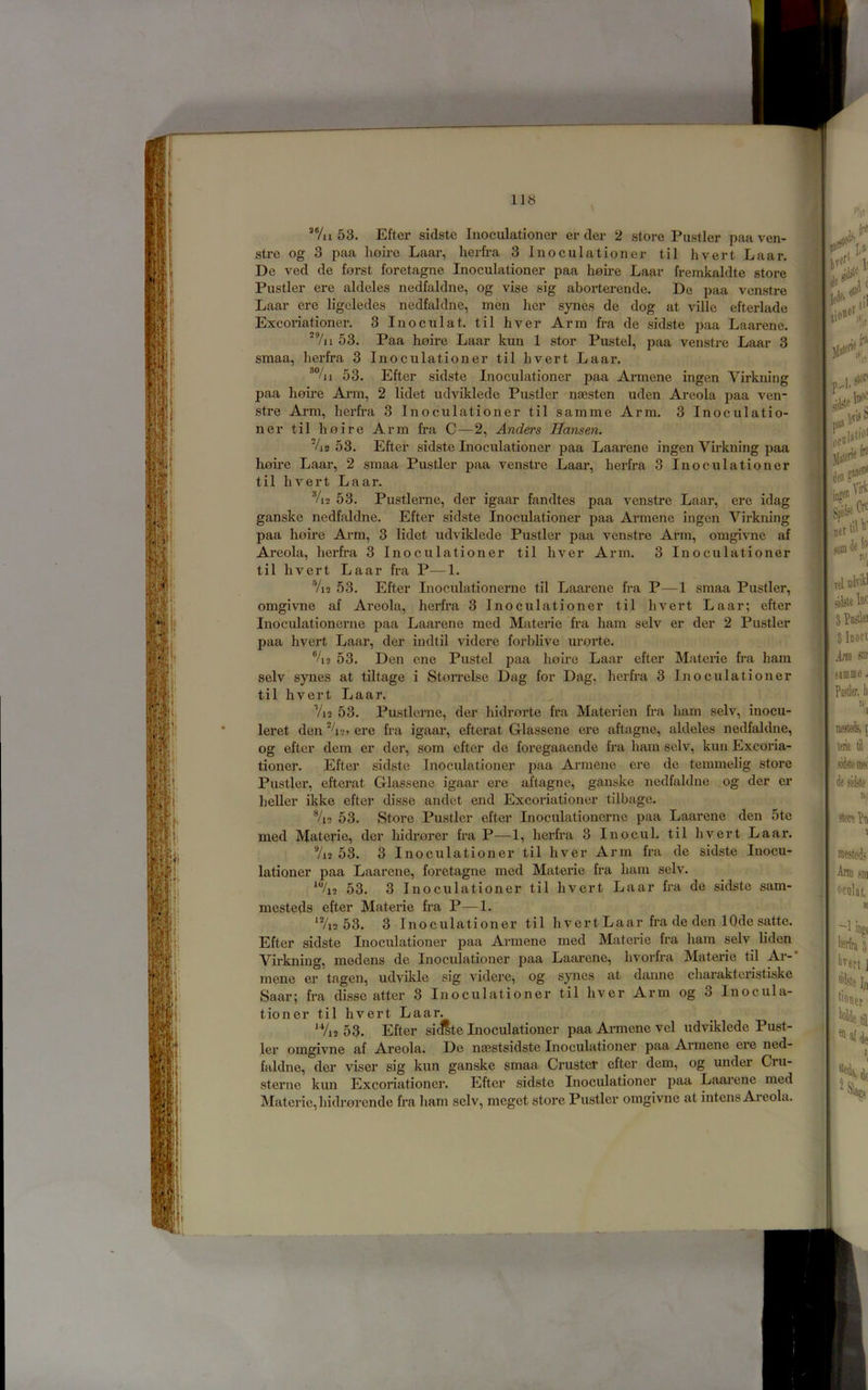 *Vii 53. Efter sidstc Inoculationer er der 2 store Fustier paa ven- stre og 3 paa hoire Laar, herfra 3 Inoculationer til hvert Laar. De ved de forst foretagne Inoculationer paa hoii-e Laar fremkaldte store Fustier ere aldcles nedfaldne, og vise sig aborterende. De paa vcnstre Laar ere ligcledes nedfaldne, men her synes de dog at ville efterlade Excoriationer. 3 Inoculat. til hver Arm fra de sidste paa Laarene. ^7ii 53. Faa hoire Laar kun 1 stor Fustel, paa venstre Laar 3 smaa, herfra 3 Inoculationer til hvert Laar. ^%i 53. Efter sidste Inoculationer paa Armene ingen Virkning paa hoire Arm, 2 lidet udviklede Fustier nsesten uden Areola jiaa ven- stre Arm, herfra 3 Inoculationer til samme Arm. 3 Inoculatio- ner til hoire Arm fra C—2, Anders Hansen. '/i2 53. Efter sidste Inocxilationer paa Laarene ingen Vmkning paa home Laar, 2 smaa Fustier paa venstre Laar, herfra 3 Inoculationer til hvert Laar. %2 53. Fustlerne, der igaar fandtes paa venstre Laar, ere idag ganske nedfaldne. Efter sidste Inoculationer paa Armene ingen Virkning paa hoire Arm, 3 lidet udviklede Fustier paa venstre Arm, omgivne af Areola, herfra 3 Inoculationer til hver Arm. 3 Inoculationer til hvert Laar fra F—1. %2 53. Efter Inoculationerne til Laarene fra F—1 smaa Fustier, omgivne af Areola, herfra 3 Inoculationer til hvert Laar; efter Inoculationerne paa Laarene med Materie fra ham selv er der 2 Fustier paa hvert Laar, der indtil videre forblive urorte. %2 53. Den ene Fustel paa hoire Laar efter Materie fra ham selv synes at tiltage i StoiTelse Dag for Dag, herfr’a 3 Inoculationer til hvert Laar. 7i2 53. Fustlerne, der hidi’orte fra Materien fra ham selv, inocu- leret den ere fra igaar, efterat Glassene ere aftagne, aldeles nedfaldne, og efter dem er der, som efter de foregaaende fra ham selv, kun Excoria- tioner. Efter sidste Inoculationer paa Armene ere de temmelig store Fustier, efterat Glassene igaar ere aftagne, ganske nedfaldne og der er heller ikke efter disse andet end Excoriationer tilbage. %2 53. Store Fustier efter Inoculationerne paa Laarene den 5te med Ma.terie, der hidrorer fra F—1, herfra 3 Inocul. til hvert Laar. 7i2 53. 3 Inoculationer til hver Arm fra de sidste Inocu- lationer paa Laarene, foretagne med Materie fra ham selv. ^%2 53. 3 Inoculationer til hvert Laar fra de sidstc sam- mesteds efter Materie fr’a F—1. ^Vi2 53. 3 Inoculationer til hvert Laar fra de den lOde satte. Efter sidste Inoculationer paa Armene med Materie fra ham selv liden Virkning, medens de Inoculationer paa Laai’ene, hvorfra Materie til Ar-* mene er tagen, udvikle sig videre, og synes at danne charakteristiske Saar; fra disse atter 8 Inoculationer til hver Arm og 3 Inocula- tioner til hvert Laar. ^Vi2 53. Efter sicHte Inoculationer paa Armene vel udviklede Fust- ier omgivne af Aneola. De naestsidste Inoculationer paa Armene ere ned- faldne, der viser sig kun ganske smaa Cruster efter dem, og under Cru- sterne kun Excoriationer. Efter sidste Inoculationer paa Laai’cne med Materie, hidrorende fra ham selv, meget store Fustier omgivne at intens Areola.