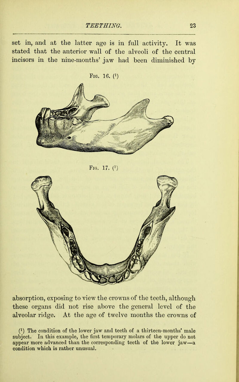 set in, and at the latter age is in full activity. It was stated that the anterior wall of the alveoli of the central incisors in the nine-months' jaw had been diminished by Fig. 16. (1) absorption, exposing to view the crowns of the teeth, although these organs did not rise above the general level of the alveolar ridge. At the age of twelve months the crowns of {}) The condition of the lower jaw and teeth of a thirteen-months' male subject. In this example, the first temporary molars of the upper do not appear more advanced than the corresponding teeth of the lower jaw—a condition which is rather unusual.