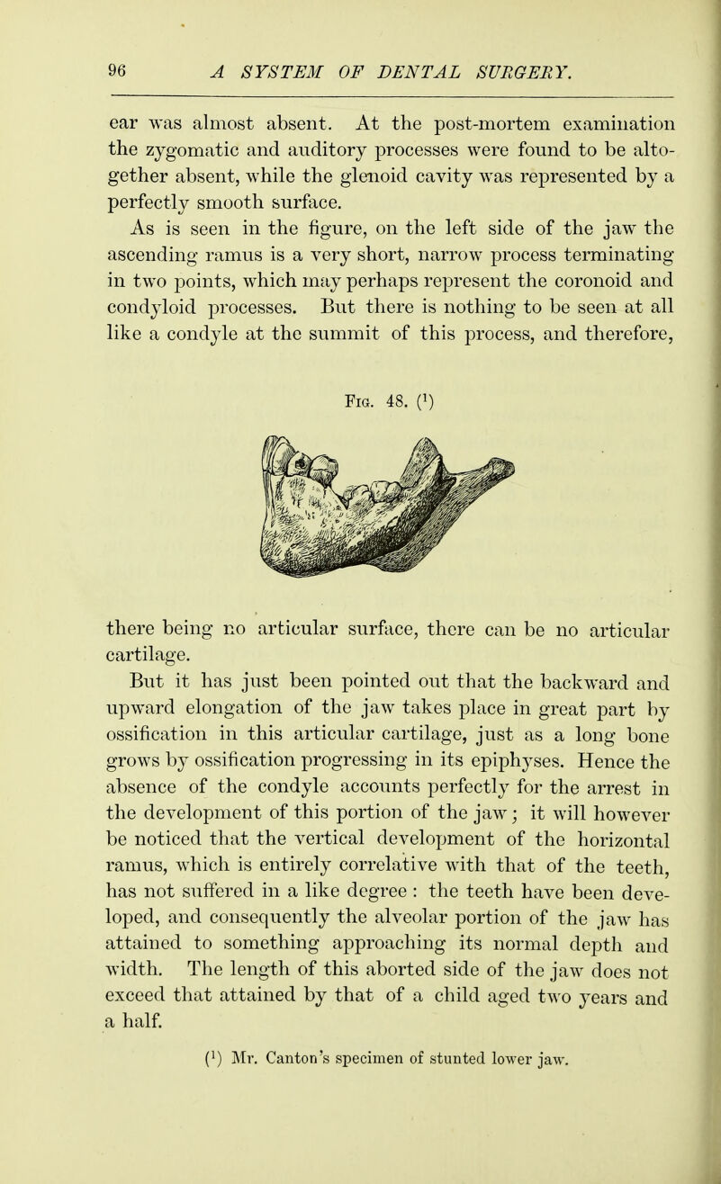 ear was almost absent. At the post-mortem examination the zygomatic and auditory processes were found to be alto- gether absent, while the glenoid cavity was represented by a perfectly smooth surface. As is seen in the figure, on the left side of the jaw the ascending ramus is a very short, narrow process terminating in two points, which may perhaps represent the coronoid and condyloid processes. But there is nothing to be seen at all like a condyle at the summit of this process, and therefore, Fig. 48. (i) there being no articular surface, there can be no articular cartilage. But it has just been pointed out that the backward and upward elongation of the jaw takes place in great part by ossification in this articular cartilage, just as a long bone grows by ossification progressing in its epiphyses. Hence the absence of the condyle accounts perfectly for the arrest in the development of this portion of the jaw; it will however be noticed that the vertical development of the horizontal ramus, which is entirely correlative with that of the teeth, has not suff'ered in a like degree : the teeth have been deve- loped, and consequently the alveolar portion of the jaw has attained to something approaching its normal deptli and width. The length of this aborted side of the jaw does not exceed that attained by that of a child aged two years and a half (1) Mr. Canton's specimen of stunted lower jaw.