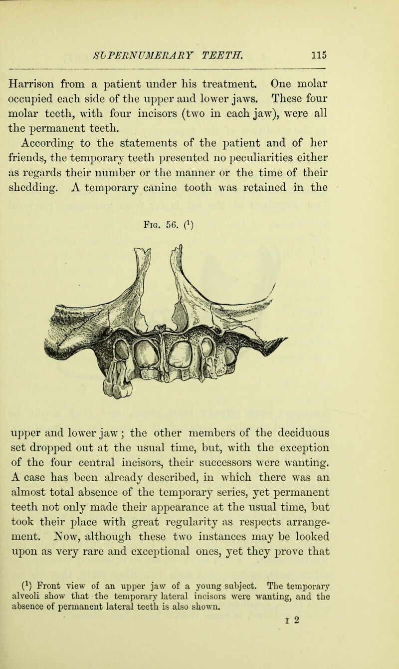 Harrison from a 23atient under his treatment. One molar occupied each side of the upper and lower jaws. These four molar teeth, wdth four incisors (two in each jaw^), were all the permanent teeth. According to the statements of the patient and of her friends, the temporary teeth presented no peculiarities either as regards their number or the manner or the time of their shedding. A temporary canine tooth was retained in the Fig. 56. (^) upper and lower jaw; the other members of the deciduous set drojjped out at the usual time, but, with the exception of the four central incisors, their successors were wanting. A case has been already described, in which there was an almost total absence of the temporarj^ series, yet permanent teeth not only made their appearance at the usual time, but took their place with great regularity as respects arrange- ment. Now, although these two instances may be looked upon as very rare and exceptional ones, yet they prove that {}) Front view of an upper jaw of a young subject. The temporary alveoli show that the temporary lateral incisors were wanting, and the absence of permanent lateral teeth is also shown. I 2