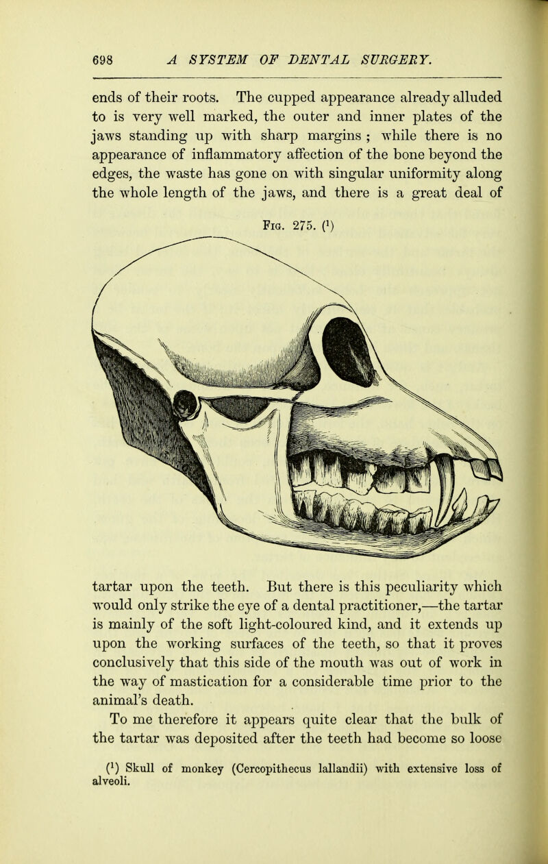 ends of their roots. The cupped appearance already alluded to is very well marked, the outer and inner plates of the jaws standing up with sharp margins ; while there is no appearance of inflammatory affection of the bone beyond the edges, the waste has gone on with singular uniformity along the whole length of the jaws, and there is a great deal of Fia. 275. C) tartar upon the teeth. But there is this peculiarity which would only strike the eye of a dental practitioner,—the tartar is mainly of the soft light-coloured kind, and it extends up upon the working surfaces of the teeth, so that it proves conclusively that this side of the mouth was out of work in the way of mastication for a considerable time prior to the animal's death. To me therefore it appears quite clear that the bulk of the tartar was deposited after the teeth had become so loose (^) Skull of monkey (Cercopithecus lallandii) with extensive loss of alveoli.