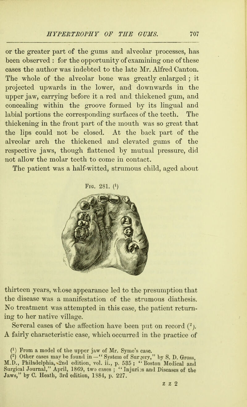 or the greater part of the gums and alveolar processes, has been observed : for the opportunity of examining one of these cases the author was indebted to the late Mr. Alfred Canton. The whole of the alveolar bone was greatly enlarged ; it projected upwards in the lower, and downwards in the upper jaw, carrying before it a red and thickened gum, and concealing within the groove formed by its lingual and labial portions the corresponding surfaces of the teeth. The thickening in the front part of the mouth was so great that the lips could not be closed. At the back part of the alveolar arch the thickened and elevated gums of the respective jaws, though flattened by mutual pressure, did not allow the molar teeth to come in contact. The patient was a half-witted, strumous child, aged about Fig. 281. 0) thirteen years, whose appearance led to the presumption that the disease was a manifestation of the strumous diathesis. No treatment was attempted in this case, the patient return- ing to her native village. Several cases of the affection have been put on record (^j. A fairly characteristic case, which occurred in the practice of (^) From a model of tlie upper jaw of Mr. Syme's case. (2) Other cases may be found in —  System of SHr,'ery, by S. D. Gross, M.D., Philadelphia,N2nd edition, vol. ii., p. 535; Boston Medical and Surgical Journal, April, 1869, two c:\ses ;  Injuries and Diseases of the Jaws, by C. Heath, 3rd edition, 1884, p. 227. z z 2