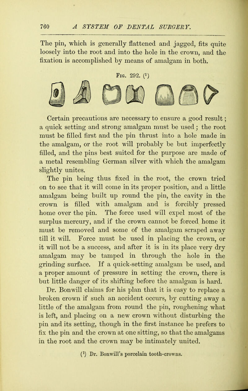 The pin, which is generally flattened and jagged, fits quite loosely into the root and into the hole in the crown, and the fixation is accomplished by means of amalgam in both. Fig. 292. (i) Certain precautions are necessary to ensure a good result; a quick setting and strong amalgam must be used; the root must be filled first and the pin thrust into a hole made in the amalgam, or the root will probably be but imperfectly filled, and the pins best suited for the purpose are made of a metal resembling German silver with which the amalgam slightly unites. The pin being thus fixed in the root, the crown tried on to see that it will come in its proper position, and a little amalgam being built up round the pin, the cavity in the crown is filled with amalgam and is forcibly pressed home over the pin. The force used will expel most of the surplus mercury, and if the crown cannot be forced home it must be removed and some of the amalgam scraped away till it will. Force must be used in placing the crown, or it will not be a success, and after it is in its place very dry amalgam may be tamped in through the hole in the grinding surface. If a quick-setting amalgam be used, and a proper amount of pressure in setting the crown, there is but little danger of its shifting before the amalgam is hard. Dr. Bonwill claims for his plan that it is easy to replace a broken crown if such an accident occurs, by cutting away a little of the amalgam from round the pin, roughening what is left, and placing on a new crown without disturbing the pin and its setting, though in the first instance he prefers to fix the pin and the crown at one sitting, so that the amalgams in the root and the crown may be intimately united. (^) Dr. Bonwill's XJorcelain tooth-crowns.