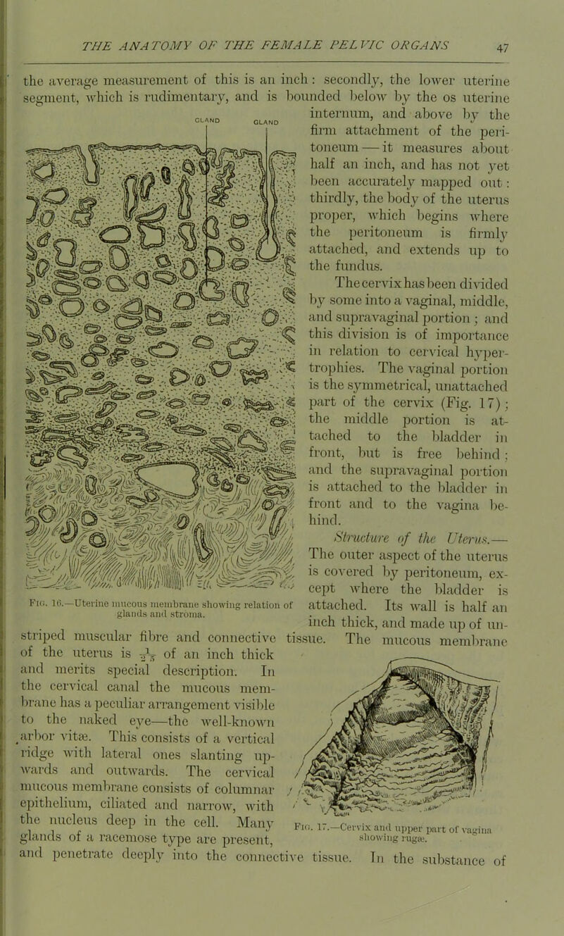 the average measurement of this is an inch : secondly, the lower uterine segment, which is rudimentary, and is hounded below by the os uterine internum, and above by the firm attachment of the peri- toneum — it measures about half an inch, and has not yet been accurately mapped out: thirdly, the body of the uterus proper, which begins where the peritoneum is firmly attached, and extends up to the fundus. The cervix has been divided by some into a vaginal, middle, and supravaginal portion ; and this division is of importance in relation to cervical hyper- trophies. The vaginal portion is the symmetrical, unattached part of the cervix (Fig. 17); the middle portion is at- tached to the bladder in front, but is free behind ; and the supravaginal portion is attached to the bladder in front and to the vagina be- hind. Structure of the Uterus.— The outer aspect of the uterus is covered by peritoneum, ex- cept where the bladder is attached. Its wall is half an inch thick, and made up of un- tissue. The mucous membrane Pig. 16.- -Uterine mucous membrane showing relation of glands and stroma. striped muscular fibre and connective of the uterus is of an inch thick and merits special description. In the cervical canal the mucous mem- brane has a peculiar arrangement visible to the naked eye—the well-known arbor vita;. This consists of a vertical ridge with lateral ones slanting up- wards and outwards. The cervical mucous membrane consists of columnar epithelium, ciliated and narrow, with the nucleus deep in the cell. Many glands of a racemose type are present, and penetrate deeply into the connective tissue. In Fio. 17.—Cervix and upper part of vagina showing ruga;. the substance o