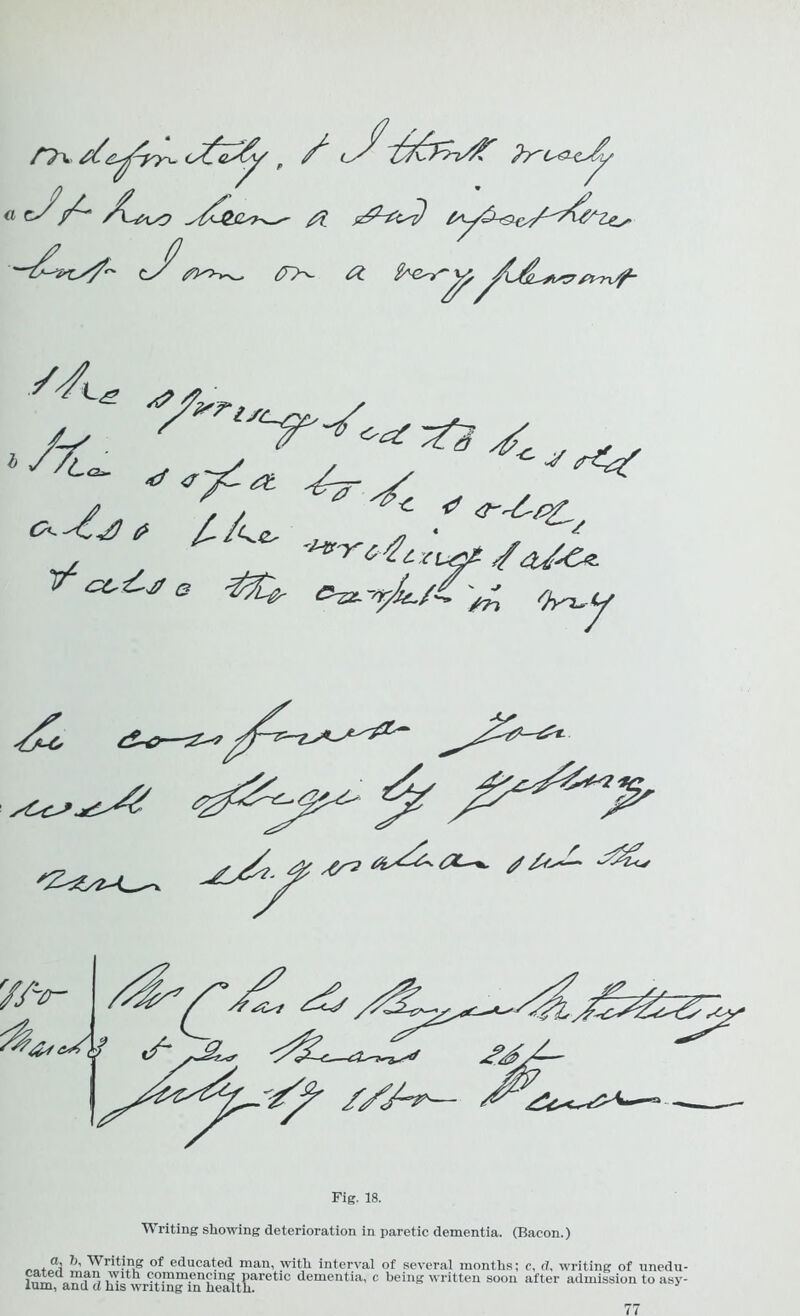 « Cx/^/^' sZ^ACst) tJ^$~a a ^l^L^&tx//- X? /V y7‘- oX* ^7^ /*. ~r.L^ V* e ^-^/, **'yr6-4cxi&t /<%/■&*. tn /h^y x<pl^& A*^p <z*»t^ '*■ Yfrr c? */ fAA- Fig. 18. Writing showing deterioration in paretic dementia. (Bacon.) ■ 3 °^ e^u°ated man, with interval of several months; c, d. writing of unedu i,,™ Vnfrlj i'^Ith commencing paretic dementia, c being written soon after admission to asy turn, and a his writing in health.