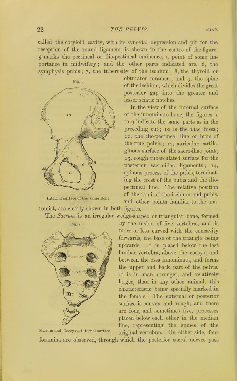 Fig. 6. called the cotyloid cavity, with its synovial depression and pit for the reception of the round ligament, is shown in the centre of the figure. 5 marks the pectineal or ilio-pectineal eminence, a point of some im- portance in midwifery; and the other parts indicated are, 6, the symphysis pubis; 7, the tuberosity of the ischium; 8, the thyroid or obturator foramen; and 9, the spine of the ischium, which divides the great posterior gap into the greater and lesser sciatic notches. I11 the view of the internal surface of the innominate bone, the figures 1 to 9 indicate the same parts as in the preceding cut; 10 is the iliac fossa; 11, the ilio-pectineal line or brim of the true pelvis; 12, auricular cartila- ginous surface of the sacro-iliac joint; 13, rough tuberculated surface for the posterior sacro-iliac ligaments; 14, spinous process of the pubis, terminat- ing the crest of the pubis and the ilio- pectineal line. The relative position of the rami of the ischium and pubis, and other points familiar to the ana- tomist, are clearly shown in both figures. The Sacrum is an irregular wedge-shaped or triangular bone, formed Fig. 7. by the fusion of five vertebrae, and is more or less curved with the concavity forwards, the base of the triangle being upwards. It is placed below the last lumbar vertebra, above the coccyx, and between the ossa innominata, and forms the upper and back part of the pelvis. It is in man stronger, and relatively larger, than in any other animal, this characteristic being specially marked in the female. The external or posterior surface is convex and rough, and there are four, and sometimes five, processes placed below each other in the median line, representing the spines of the sacrum and Coccyx—internal surface, original vertebrae. On either side, four foramina are observed, through which the posterior sacral nerves pass Internal surface of the same Bone.