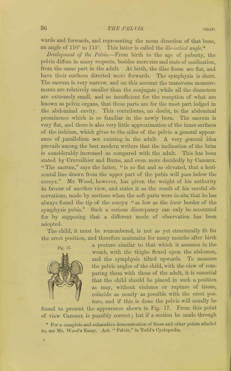 30 THE EEL VIE CHAP. wards and forwards, and representing the mean direction of that bone, an angle of 110° to 115°. This latter is called the ilio-ischiul angle * Development of the Pelvh.—From birth to the age of puberty, the pelvis differs in many respects, besides mere size and state of ossification, from the same part in the adidt. At birth, the iliac fossae are flat, and have their surfaces directed more forwards. The symphysis is short. The sacrum is very narrow, and on this account the transverse measure- ments are relatively smaller than the conjugate; while all the diameters are extremely small, and so insufficient for the reception of what are known as pelvic organs, that these parts are for the most part lodged in the abdominal cavity. This contributes, no doubt, to the abdominal prominence which is so familiar in the newly born. The sacrum is very flat, and there is also very little approximation of the inner surfaces of the ischium, which gives to the sides of the pelvis a general appear- ance of parallelism not existing in the adult. A very general idea prevails among the best modern writers that the inclination of the brim is considerably increased as compared with the adult. This has been stated by Cruveilhier and Burns, and even more decidedly by Cazeaux. “ The sacrum,” says the latter, “ is so flat and so elevated, that a hori- zontal line drawn from the upper part of the pubis will pass below the coccyx.” Mr. Wood, however, has given the weight of his authority in favour of another view, and states it as the result of his careful ob- servations, made by sections when the soft parts were in situ, that he has always found the tip of the coccyx “ as low as the lower border of the symphysis pubis.” Such a serious discrepancy can only be accounted for by supposing that a different mode of observation has been adopted. The child, it must be remembered, is not as yet structurally fit for the erect position, and therefore maintains for many months after birth a posture similar to that which it assumes in the womb, with the thighs flexed upon the abdomen, and the symphysis tilted upwards. To measure the pelvic angles of the child, with the view of com- paring them with those of the adult, it is essential that the child should be placed in such a position as may, without violence or rupture of tissue, coincide as nearly as possible with the erect pos- ture, and if this is done the pelvis will usually bo found to present the appearance shewn in Fig. 17. From this point of view Cazeaux is possibly correct; but if a section be made through * For a complete and exhaustive demonstration of these and other points alluded to, see Mr. Wood’s Essay. Art. “ Pelvis,” in Todd’s Cyclopaedia. Fig. 17.