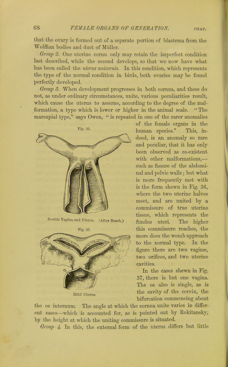 chap. that the ovary is formed out of a separate portion of blastema from the Wolffian bodies and duct of M idler. Group 2. One uterine cornu only may retain the imperfect condition last described, while the second develops, so that we now have what has been called the uterus unicornis. In this condition, which represents the type of the normal condition in birds, both ovaries may be found perfectly developed. Group 3. When development progresses in both cornua, and these do not, as under ordinary circumstances, unite, various peculiarities result, which cause the uterus to assume, according to the degree of the mal- formation, a type which is lower or higher in the animal scale. “ The marsupial type,” says Owen, “ is repeated in one of the rarer anomalies of the female organs in the human species.” This, in- deed, is an anomaly so rare and peculiar, that it has only been observed as co-existent with other malformations,— such as fissure of the abdomi- nal and pelvic walls; but what is more frequently met with is the form shewn in Fig. 36, Avhere the two uterine halves meet, and are united by a commissure of true uterine tissue, which represents the fundus uteri. The higher this commissure reaches, the more does the womb approach to the normal type. In the figure there are two vagime, two orifices, and two uterine cavities. In the cases sheAvn in Fig. 37, there is but one vagina. The os also is single, as is the cavity of the cervix, the bifurcation commencing about the os internum. The angle at which the cornua unite Agarics in differ- ent cases—which is accounted for, as is pointed out by Rokitansky, by the height at which the uniting commissure is situated. Group J/.. In this, the external form of the uterus differs but little Fig. 36. Double Vagina and Uterus. fAftcr Busch.) Fig. 37. Bifid Uterus.