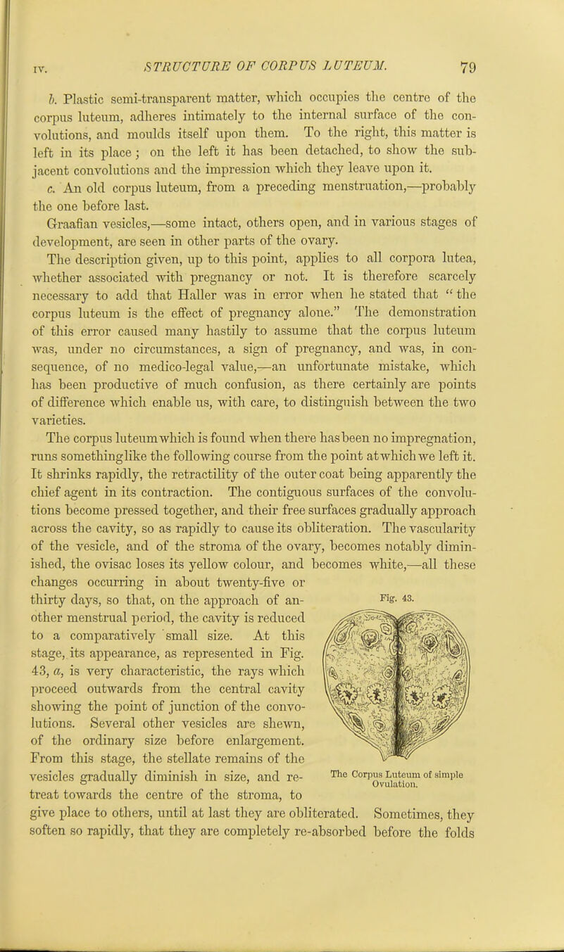 1). Plastic semi-transparent matter, which occupies the centre of the corpus luteum, adheres intimately to the internal surface of tho con- volutions, and moulds itself upon them. To the right, this matter is left in its place; on tho left it has been detached, to show the sub- jacent convolutions and the impression which they leave upon it. c. An old corpus luteum, from a preceding menstruation,—probably the one before last. Graafian vesicles,—some intact, others open, and in various stages of development, are seen in other parts of the ovary. The description given, up to this point, applies to all corpora lutea, whether associated with pregnancy or not. It is therefore scarcely necessary to add that Haller was in error when he stated that “ the corpus luteum is the effect of pregnancy alone.” The demonstration of this error caused many hastily to assume that the corpus luteum was, under no circumstances, a sign of pregnancy, and was, in con- sequence, of no medico-legal value,—an unfortunate mistake, which has been productive of much confusion, as there certainly are points of difference which enable us, with care, to distinguish between the two varieties. The corpus luteum which is found when there has been no impregnation, runs somethinglike the following course from the point at which we left it. It shrinks rapidly, the retractility of the outer coat being apparently the chief agent in its contraction. The contiguous surfaces of the convolu- tions become pressed together, and their free surfaces gradually approach across the cavity, so as rapidly to cause its obliteration. The vascularity of the vesicle, and of the stroma of the ovary, becomes notably dimin- ished, the ovisac loses its yellow colour, and becomes white,—all these changes occurring in about twenty-five or thirty days, so that, on the approach of an- other menstrual period, the cavity is reduced to a comparatively small size. At this stage, its appearance, as represented in Fig. 43, a, is very characteristic, the rays which proceed outwards from the central cavity showing the point of junction of the convo- lutions. Several other vesicles are shewn, of the ordinary size before enlargement. From this stage, the stellate remains of the vesicles gradually diminish in size, and re- treat towards the centre of the stroma, to give place to others, until at last they are obliterated. Sometimes, they soften so rapidly, that they are completely re-absorbed before the folds Fig. 43. Tho Corpus Luteum of simple Ovulation.