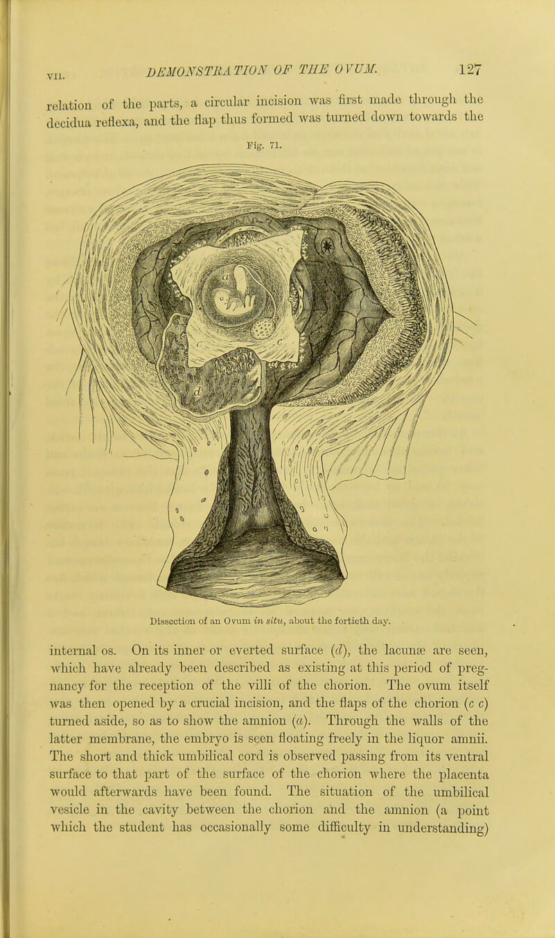 relation of the parts, a circular incision was first made through the decidua reflexa, and the flap thus formed was turned down towards the Pig. 71. internal os. On its inner or everted surface (cl), the lacunae are seen, which have already been described as existing at this period of preg- nancy for the reception of the villi of the chorion. The ovum itself was then opened by a crucial incision, and the flaps of the chorion (c c) turned aside, so as to show the amnion (a). Through the walls of the latter membrane, the embryo is seen floating freely in the liquor amnii. The short and thick umbilical cord is observed passing from its ventral surface to that part of the surface of the chorion where the placenta would afterwards have been found. The situation of the umbilical vesicle in the cavity between the chorion and the amnion (a point which the student has occasionally some difficulty in understanding) Dissection of an Ovum in situ, about the fortieth day.