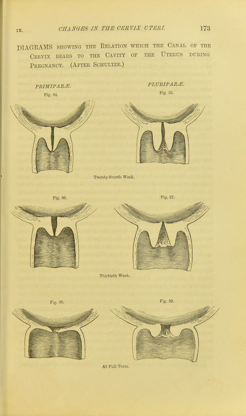 DIAGRAMS showing the Relation which the Canal oe the Cervix bears to the Cavity of the Uterus during Pregnancy. (After Schultze.) PRIMIPARJS. Fig. 84. PL URIP ARAB. Fig. 85. Twenty-fourth Week. Fig. 86. Fig. 87. Thirtieth Week. Fig. 88. Fig. 89. At Full Term.