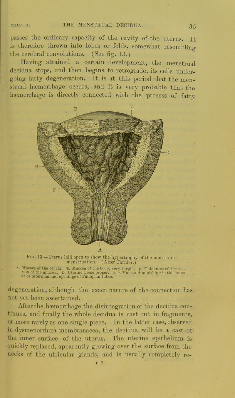 passes the ordinary capacity of the cavity of the uterus. It is therefore thrown into lobes or folds, somewhat resembling the cerebral convolutions. (See fig. 13.) Having attained a certain development, the menstrual decidua stops, and then begins to retrograde, its cells under- going fatty degeneration. It is at this period that the men- strual haemorrhage occurs, and it is very probable that the haemorrhage is directly connected with the process of fatty A Fig. 13.—Uterus laid open to show the hypertrophy of the mucosa in menstruation. (After Tarnier.) A. Jfucosa of the cervix. B. Mucosa of tlie body, very turgid, c. Thickness of the sec- tion of the mucosa. D. Uterine tissue proper. E, F. Mucosa dimiuishiug in tliickiiess at 03 intermim and openiugs of Fallopian tubes, degeneration, although the exact nature of the connection has not yet been ascertained. After the haemorrhage the disintegration of the decidua con- tinues, and finally the whole decidua is cast out in fragments, or more rarely as one single piece. In the latter case, observed in dysmenorrhoea membranacea, the decidua will be a cast of the inner surface of the uterus. The uterine epithelium is quickly replaced, apparently growing over the surface from the necks of the utricular glands, and is usually completely re- D 2