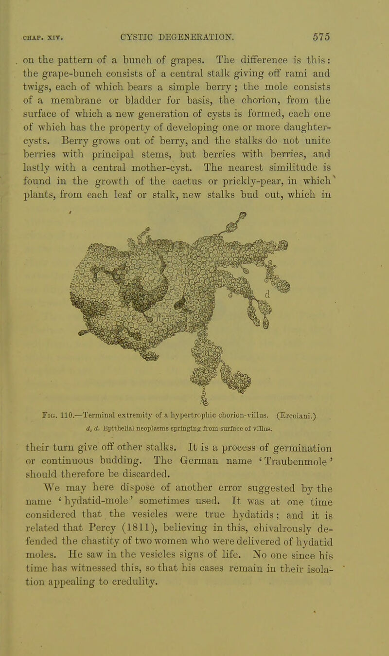 on the pattern of a bunch of grapes. The difference is this: the grape-bunch consists of a central stalk giving off rami and twigs, each of which bears a simple berry; the mole consists of a membrane or bladder for basis, the chorion, from the surface of which a new generation of cysts is formed, each one of which has the property of developing one or more daughter- cysts. Berry grows out of berry, and the stalks do not unite berries with principal stems, but berries with berries, and lastly with a central mother-cyst. The nearest similitude is found in the growth of the cactus or prickly-pear, in which ^ plants, from each leaf or stalk, new stalks bud out, which in Fig. 110.—Terminal extremity of a hypertropliic chorion-viJlus. (Ercolani.) d, d. Epithelial neoplasms springing from sixrface of villus. their turn give off other stalks. It is a process of germination or continuous budding. The Grerman name ' Traubenmole' should therefore be discarded. We may here dispose of another error suggested by the name ' hydatid-mole' sometimes used. It was at one time considered that the vesicles were true hydatids; and it is related that Percy (1811), believing in this, chivalrously de- fended the chastity of two women who were delivered of hydatid moles. He saw in the vesicles signs of life. No one since his time has witnessed this, so that his cases remain in their isola- tion appealing to credulity.