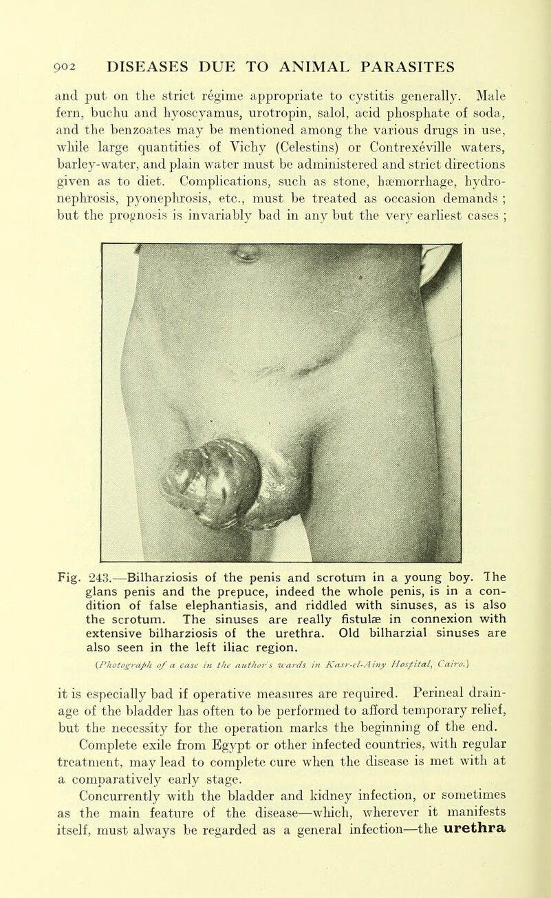 and put on the strict regime appropriate to cystitis generally. Male fern, bucliu and hyoscyamus, urotropin, salol, acid phosphate of soda, and the benzoates may be mentioned among the various drugs in use, while large quantities of Vichy (Celestins) or Contrexeville waters, barley-water, and plain water must be administered and strict directions given as to diet. Complications, such as stone, haemorrhage, hydro- nephrosis, pyonephrosis, etc., must be treated as occasion demands ; but the prognosis is invariably bad in any but the very earliest cases ; 7 Fig. 243.—Bilharziosis of the penis and scrotum in a young boy. The glans penis and the prepuce, indeed the whole penis, is in a con- dition of false elephantiasis, and riddled with sinuses, as is also the scrotum. The sinuses are really fistulae in connexion with extensive bilharziosis of the urethra. Old bilharzial sinuses are also seen in the left iliac region. (Photograph of a case in the author s uards in Kasr-cl-Ainy Hos/ital, Cairo.) it is especially bad if operative measures are required. Perineal drain- age of the bladder has often to be performed to afford temporary rehef, but the necessity for the operation marks the beginning of the end. Complete exile from Egypt or other infected countries, with regular treatment, may lead to complete cure when the disease is met with at a comparatively early stage. Concurrently with the bladder and kidney infection, or sometimes as the main feature of the disease—which, wherever it manifests itself, must always be regarded as a general infection—the urethra