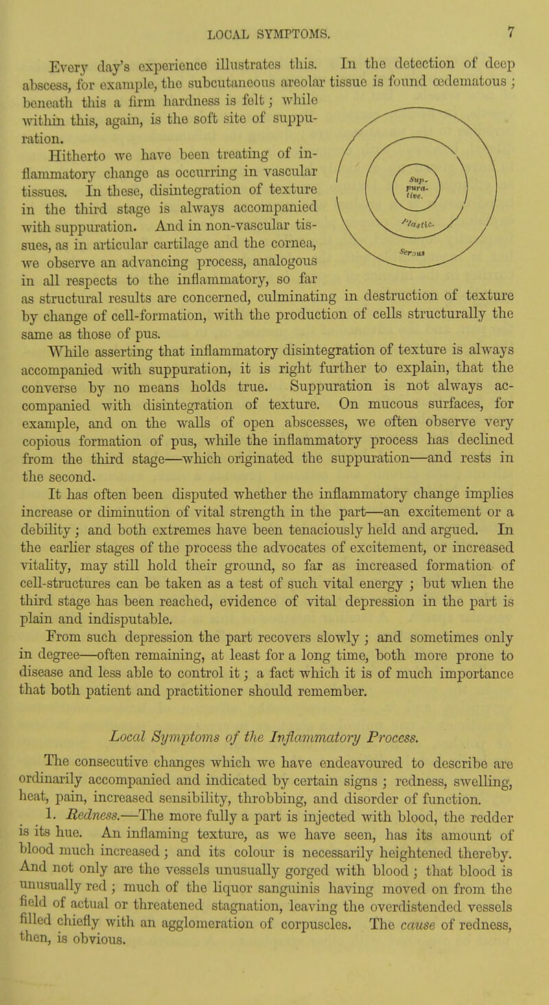 Everj-- day's oxperienco illustrates this. In the detection of deep abscess, for example, tlie subcutaneous areolar tissue is found oedematous ; beneath tliis a firm hardness is felt; while Avithin this, again, is the soft site of suppu- ration. Hitherto we have been treating of in- flammatory change as occurring in vascular tissues. In these, disintegration of texture in the third stage is always accompanied with suppiu-ation. And in non-vascular tis- sues, as in articular cartilage and the cornea, we observe an advancing process, analogous in all respects to the inflammatory, so far as structural results are concerned, culminating in destruction of texture by change of cell-formation, with the production of cells structurally the same as those of pus. While asserting that inflammatory disintegration of texture is always accompanied with suppuration, it is right further to explain, that the converse by no means holds true. Suppuration is not always ac- companied with disintegration of texture. On mucous surfaces, for example, and on the walls of open abscesses, we often observe very copious formation of pus, wliile the inflammatory process has declined from the third stage—which originated the suppuration—and rests in the second. It has often been disputed whether the inflammatory change implies increase or diminution of vital strength in the part—an excitement or a debihty; and both extremes have been tenaciously held and argued. In the earher stages of the process the advocates of excitement, or increased vitahty, may still hold their ground, so far as increased formation of cell-structures can be taken as a test of such vital energy ; but when the third stage has been reached, evidence of vital depression in the part is plain and indisputable. Trom such depression the part recovers slowly ; and sometimes only in degree—often remaining, at least for a long time, both more prone to disease and less able to control it; a fact wliicli it is of much importance that both patient and practitioner should remember. Local Symptoms of the Inflammatory Process. The consecutive changes which we have endeavoured to describe are ordinarily accompanied and indicated by certain signs ; redness, swelling, heat, pain, increased sensibility, throbbing, and disorder of function. 1. Redness.—The more fully a part is injected with blood, the redder is its hue. An inflaming texture, as we have seen, has its amount of blood much increased; and its colour is necessarily heightened thereby. And not only are the vessels unusually gorged with blood; that blood is unusually red ; much of the liquor sanguinis having moved on from the field of actual or threatened stagnation, leaving the overdistendod vessels filled chiefly with an agglomeration of corpuscles. The cause of redness, then, is obvious.