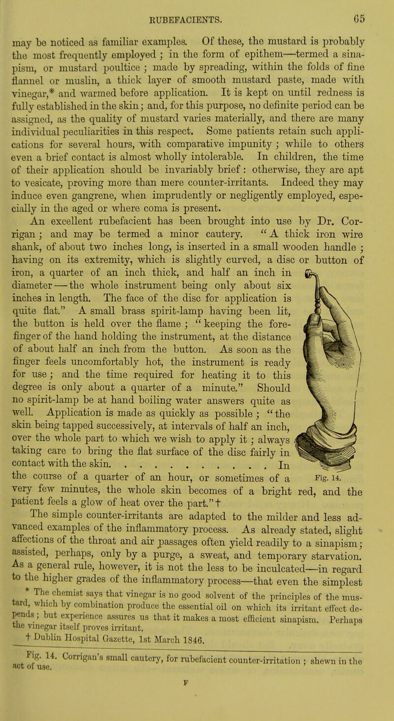 RUBEFACIENTS. G5 may be noticed as lamiliav examples. Of these, the mustard is jarobably the most frequently employed ; in the form of epithem—termed a sina- pism, or mustard poultice ; made by spreading, within the folds of fine flannel or mushn, a thick layer of smooth mustard paste, made with vinegar,* and warmed before application. It is kept on until redness is fully established in the skin; and, for this purpose, no definite period can be assigned, as the quahty of mustard varies materially, and there are many individual peculiarities in this respect. Some patients retain such appli- cations for several hours, with comparative impunity ; while to others even a brief contact is almost wholly intolerable. In children, the time of their appHcation should be invariably brief: otherwise, they are apt to vesicate, proving more than mere counter-irritants. Indeed they may induce even gangrene, when imprudently or negligently employed, espe- cially in the aged or where coma is present. An excellent rubefacient has been brought into use by Dr. Cor- rigan ; and may be termed a minor cautery.  A thick iron wire shank, of about two inches long, is inserted in a small wooden handle ; having on its extremity, which is sHghtly ciirved, a disc or button of iron, a quarter of an inch thick, and half an inch in diameter — the whole instrument being only about six inches in length. The face of the disc for application is quite flat. A small brass spirit-lamp having been lit, the button is held over the flame ;  keeping the fore- finger of the hand holding the instrument, at the distance of about half an inch from the button. As soon as the finger feels uncomfortably hot, the instrument is ready for use; and the time required for heating it to this degree is only about a quarter of a minute. Should no spirit-lamp be at hand boiling water answers quite as well Application is made as quickly as possible ;  the skin being tapped successively, at intervals of half an inch, over the whole part to which we wish to apply it; always taking care to bring the flat surface of the disc fairly in contact with the skin. In the course of a quarter of an hour, or sometimes of a very few minutes, the whole skin becomes of a bright patient feels a glow of heat over the part.t The simple counter-irritants are adapted to the milder and less ad- vanced examples of the inflammatory process. As already stated, slight afi'ections of the throat and air passages often yield readily to a sinapism; assisted, perhaps, only by a purge, a sweat, and temporary starvation. As a general rule, however, it is not the less to be inculcated—in regard to the higher grades of the inflammatory process—that even the simplest * The chemist says that vinegar is no good solvent of the principles of the mus- tard which by combination produce the essential oil on which its irritant eilect de- pends ; but experience assures us that it makes a most efficient sinapism. Perhaps the vinegar itself proves irritant. t Dublin Hospital Gazette, 1st March 1846. Fig. 14, Corrigan's small cautery, for rubefacient counter-irritation ; shewTi in the !Wt of use. Fig. 14. red, and the F